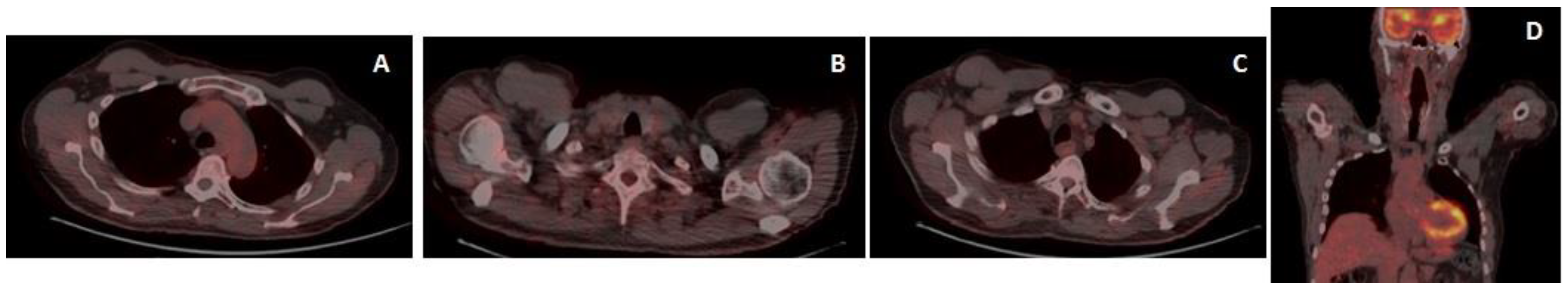 Medicina 59 00157 g006