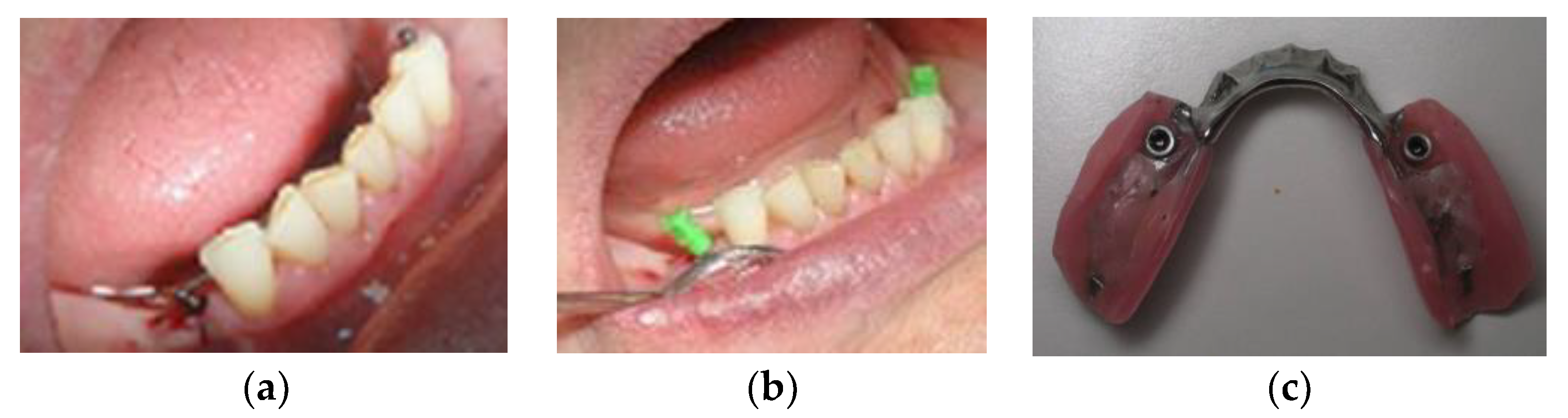 Medicina 59 00237 g002 Medicina 59 00237 g002