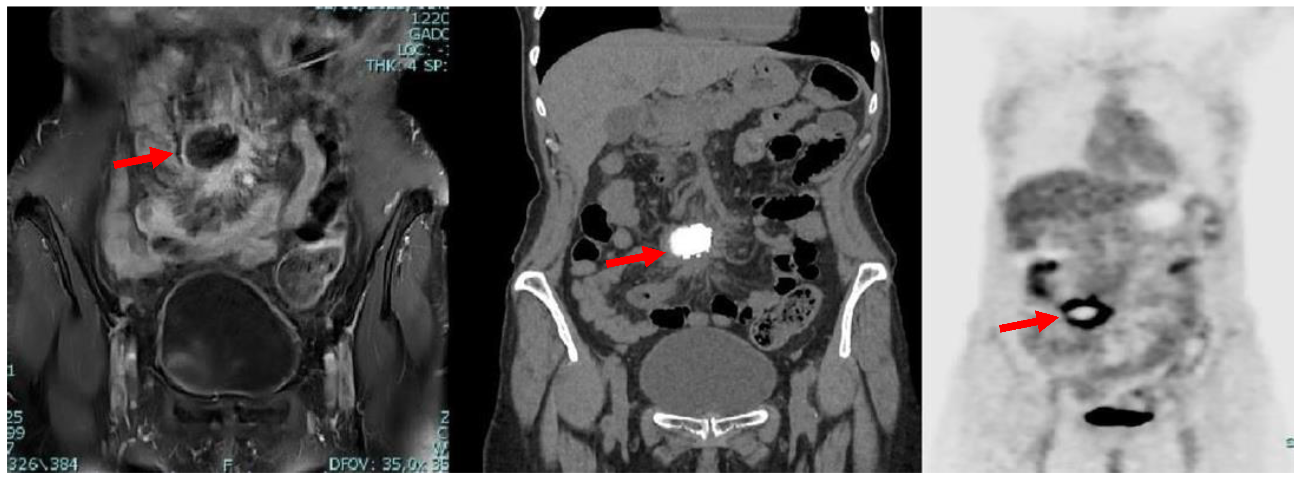 Medicina 59 00293 g002
