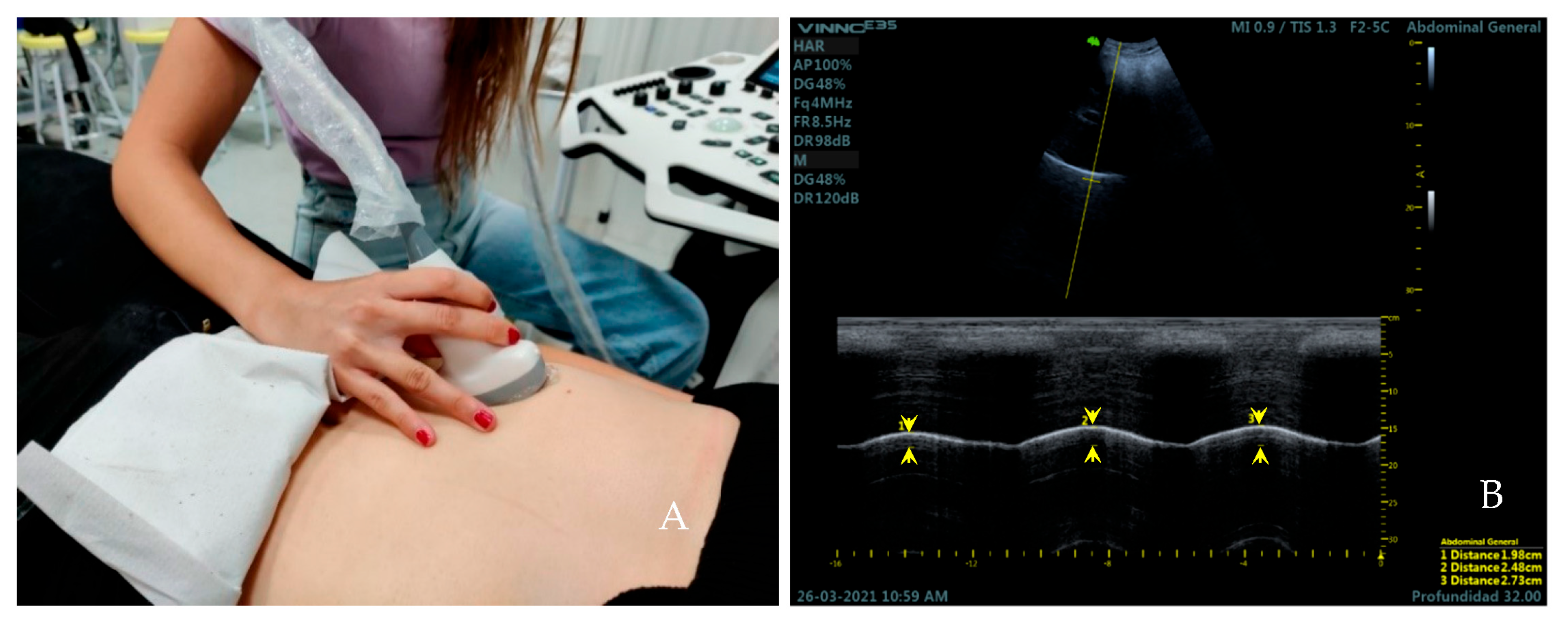 Medicina 59 00315 g002