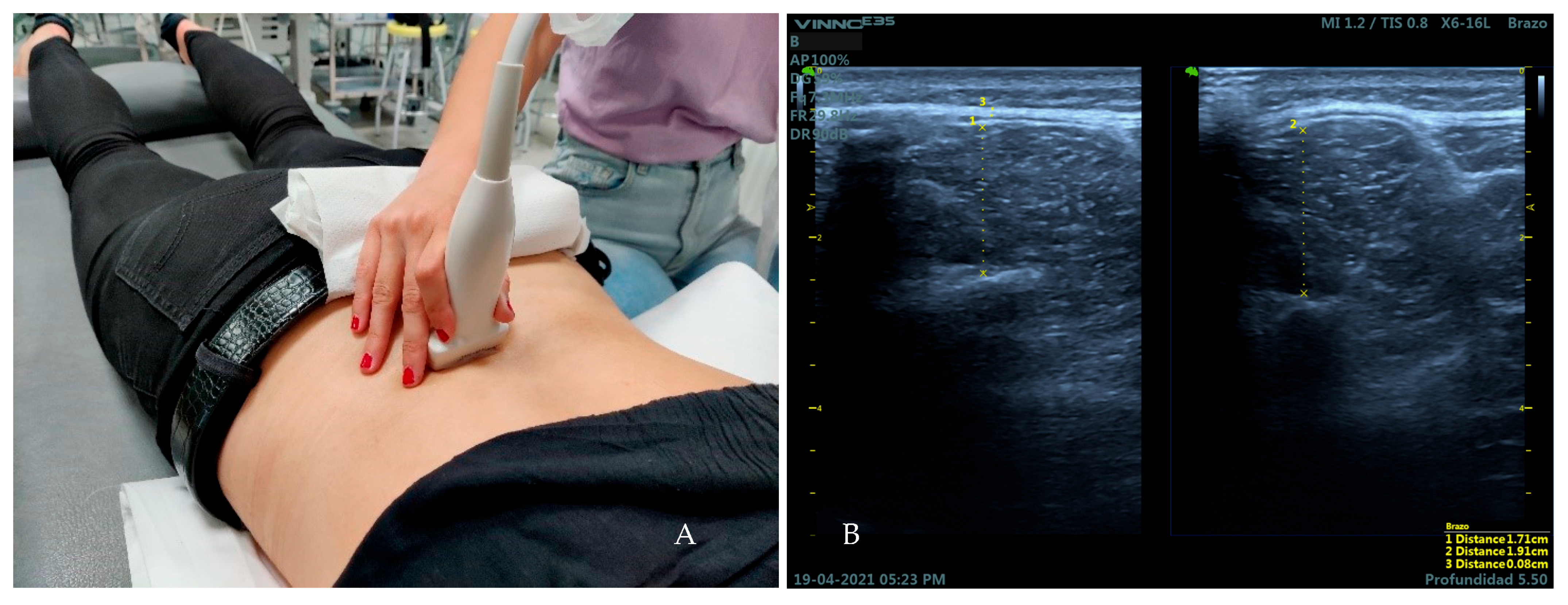 Medicina 59 00315 g003
