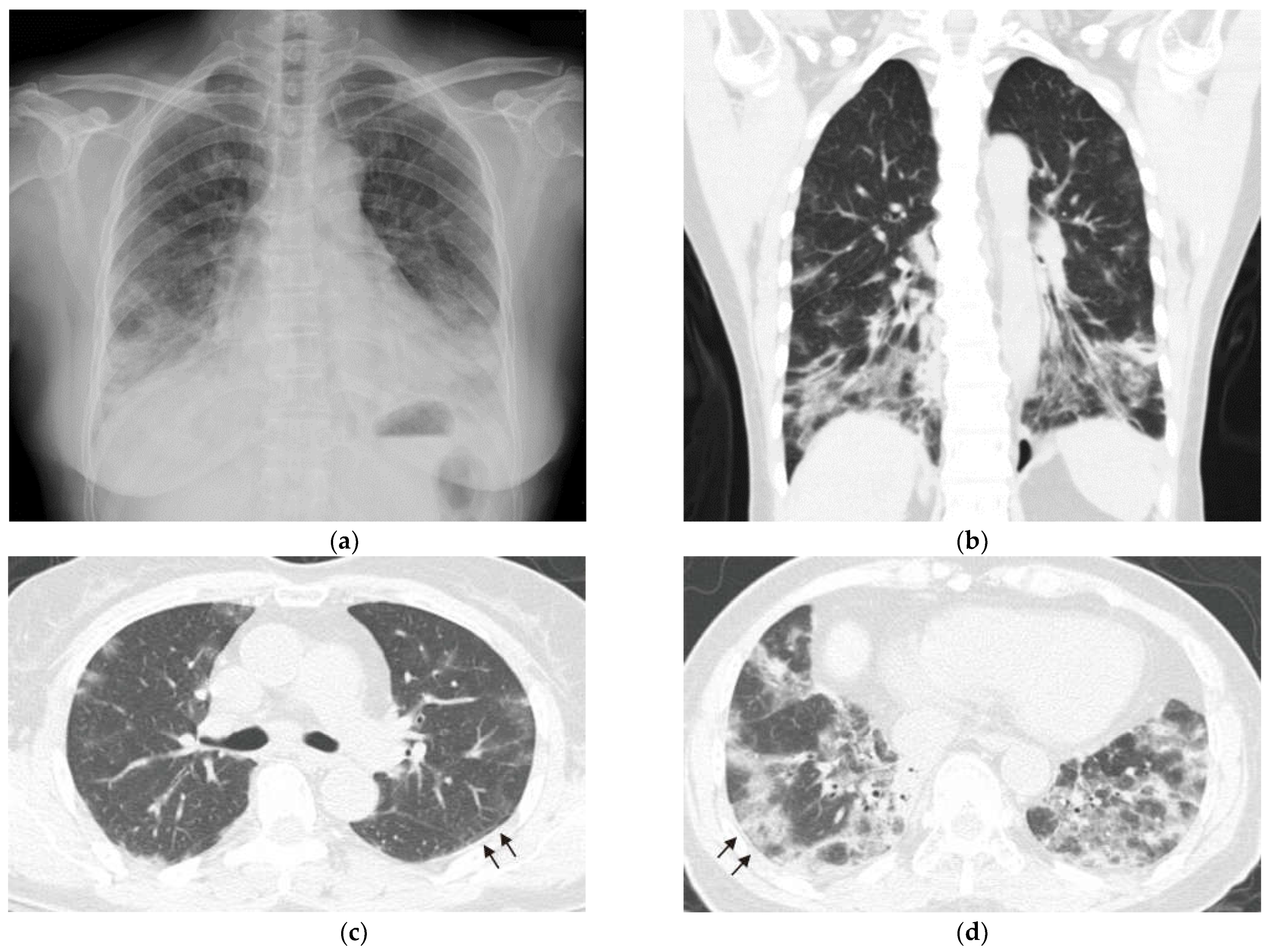 Medicina 59 00330 g001