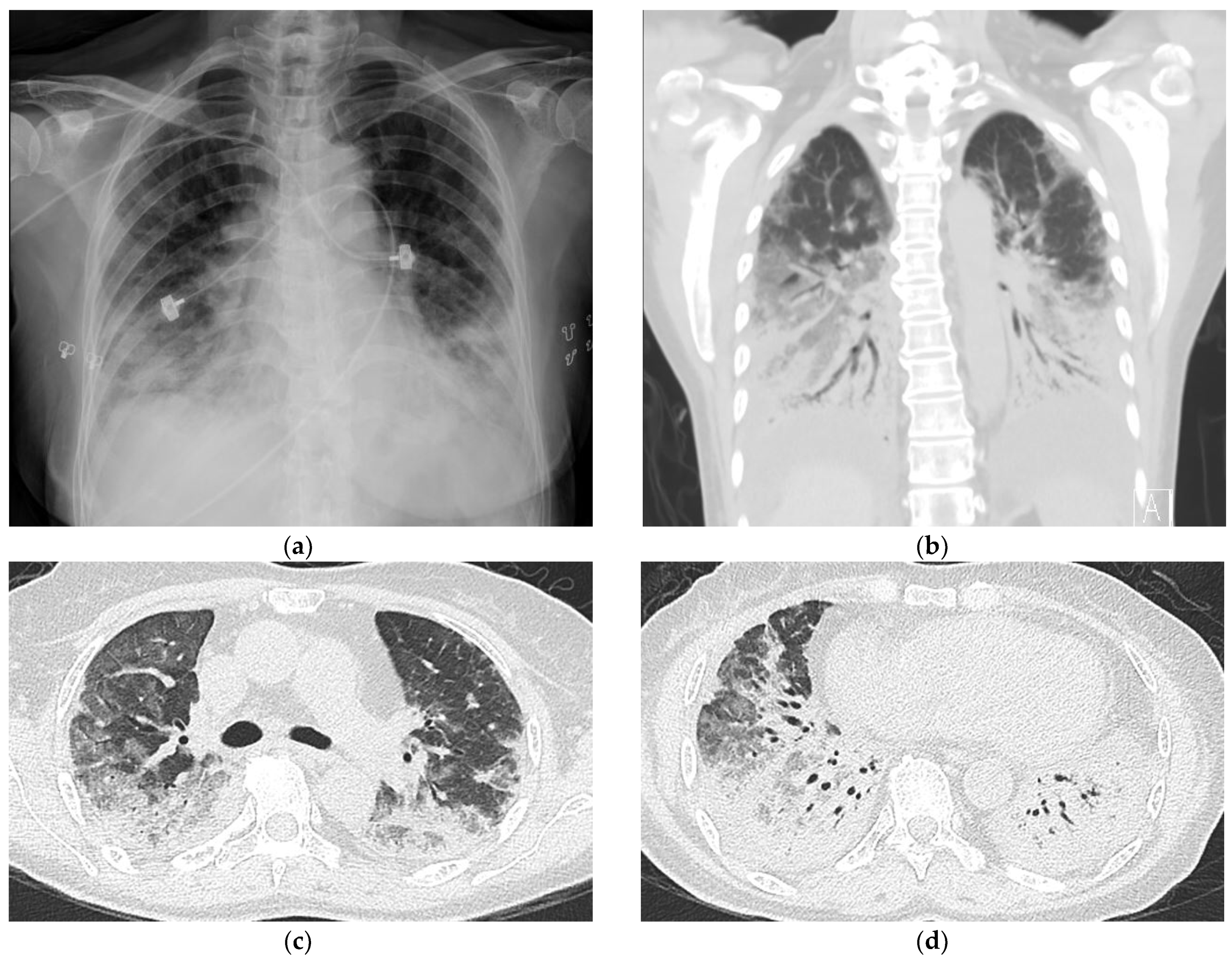 Medicina 59 00330 g002