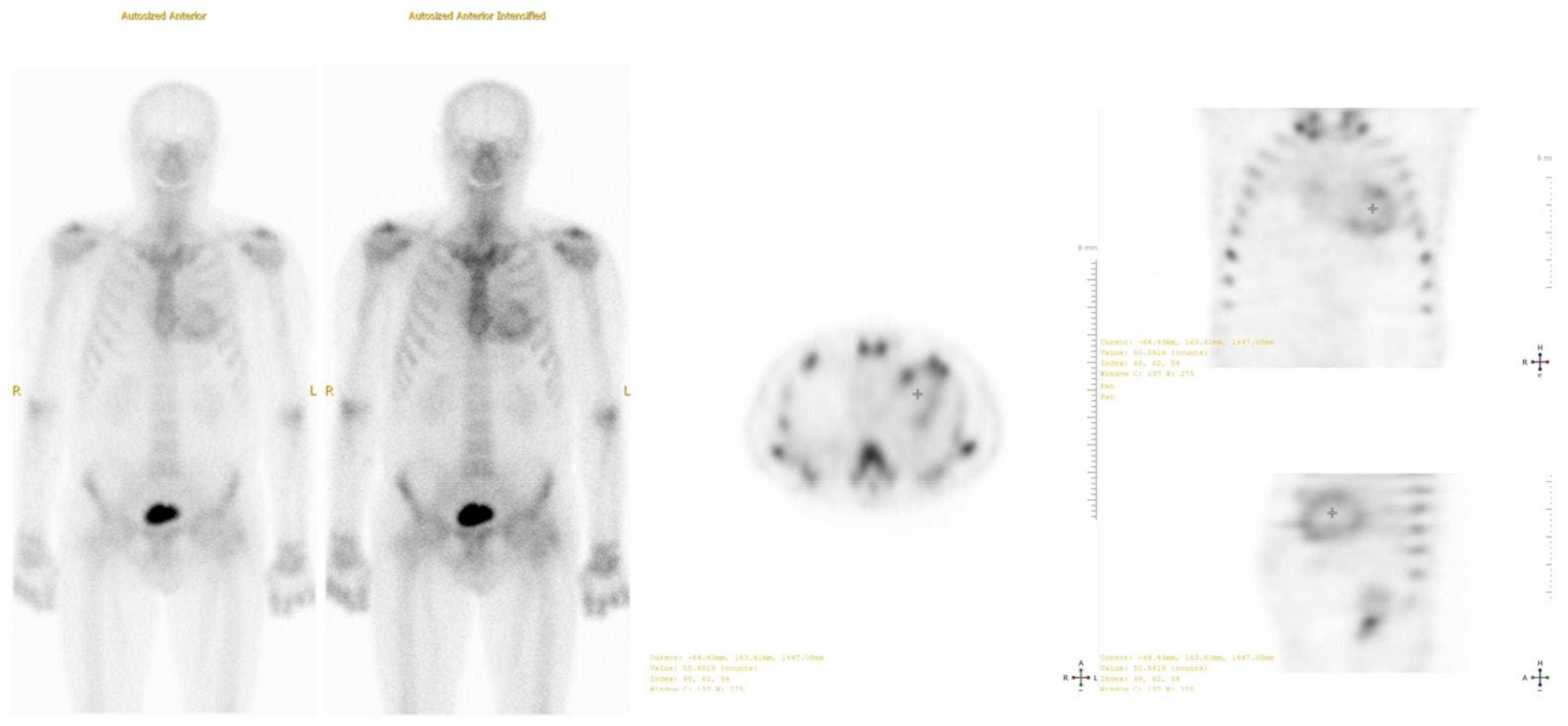 Medicina 59 00335 g005