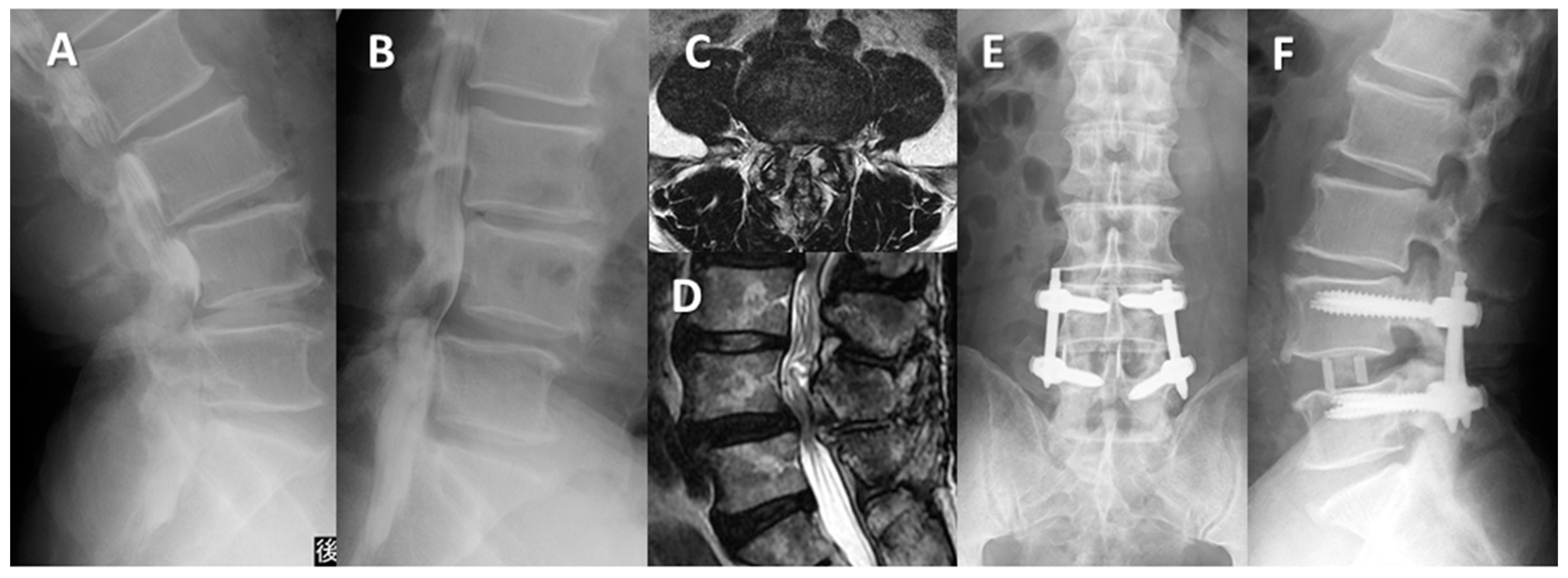 Medicina 59 00342 g006