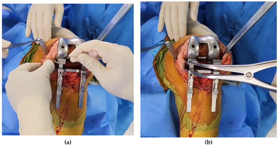 Medicina 59 00369 g003