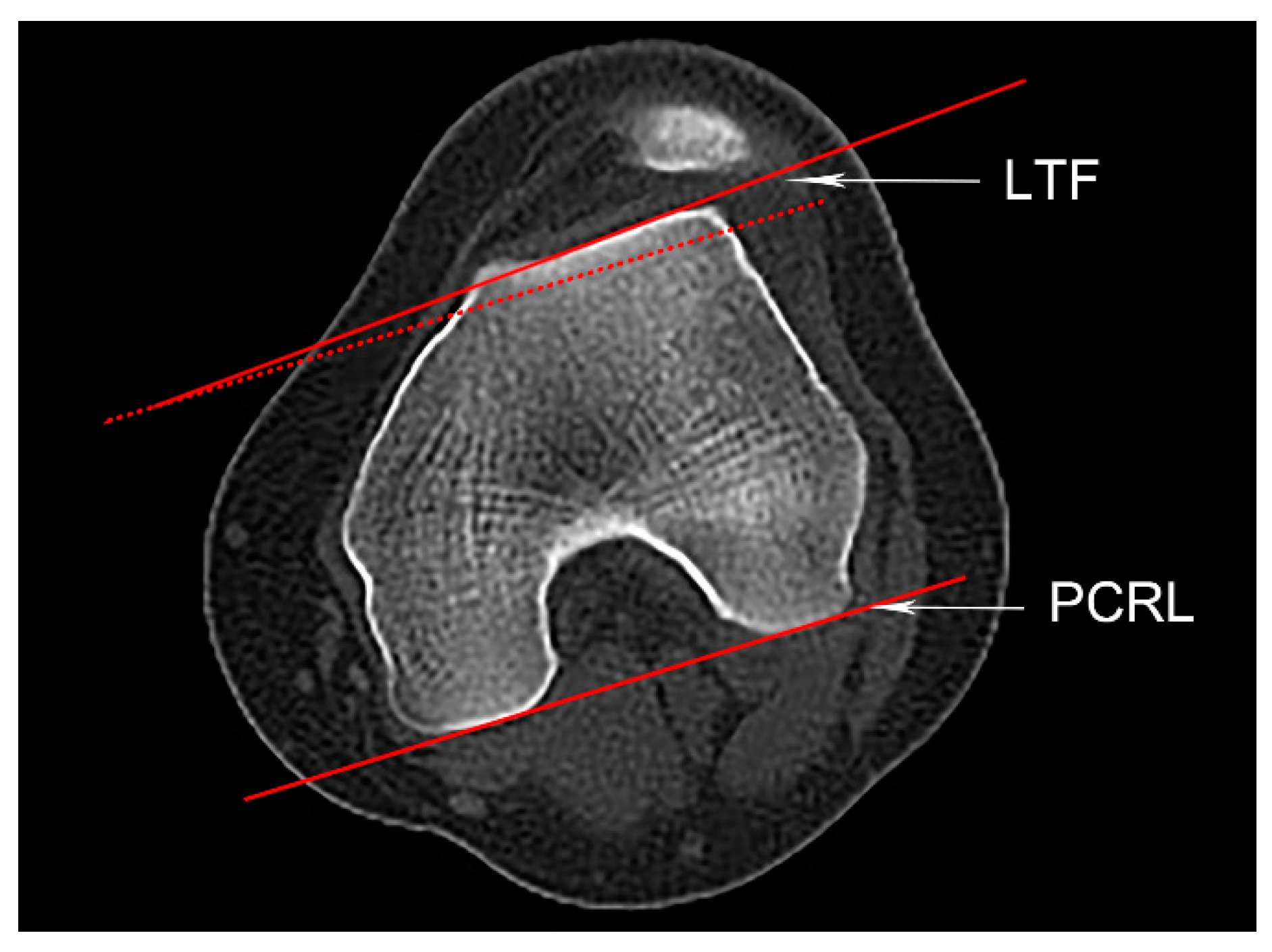 Medicina 59 00382 g002 Medicina 59 00382 g002