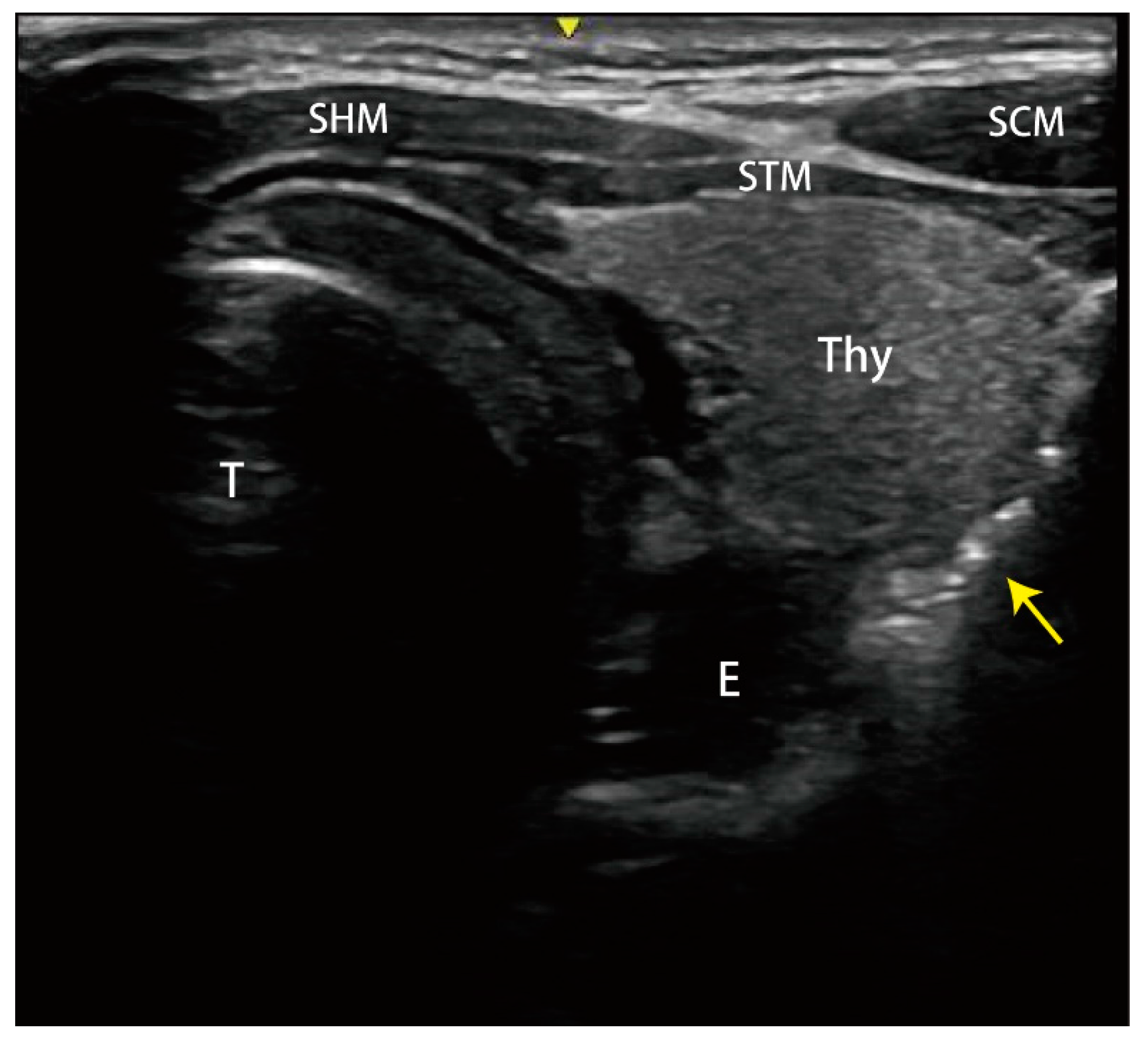 Medicina 59 00394 g001 Medicina 59 00394 g001
