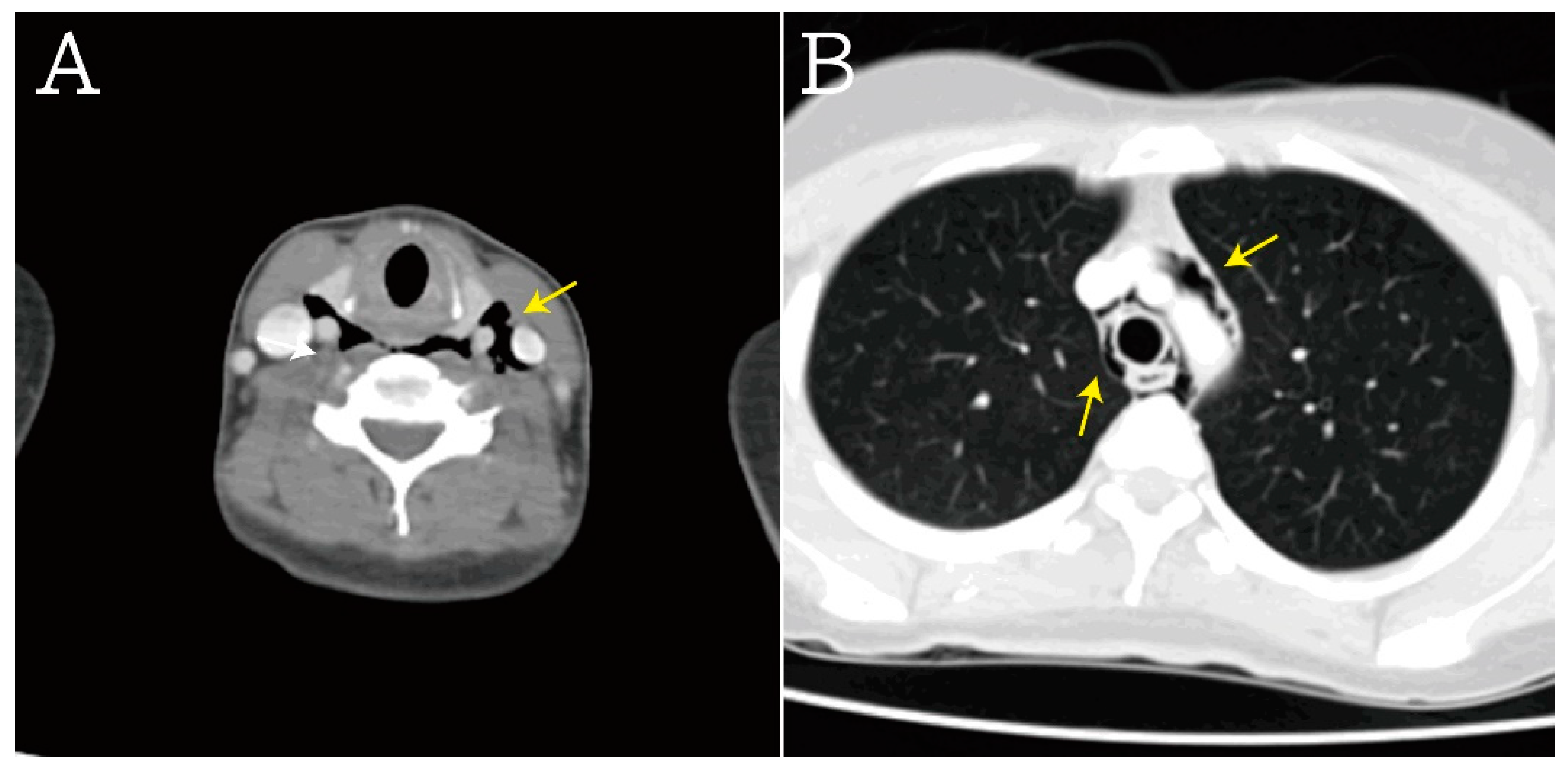 Medicina 59 00394 g003 Medicina 59 00394 g003