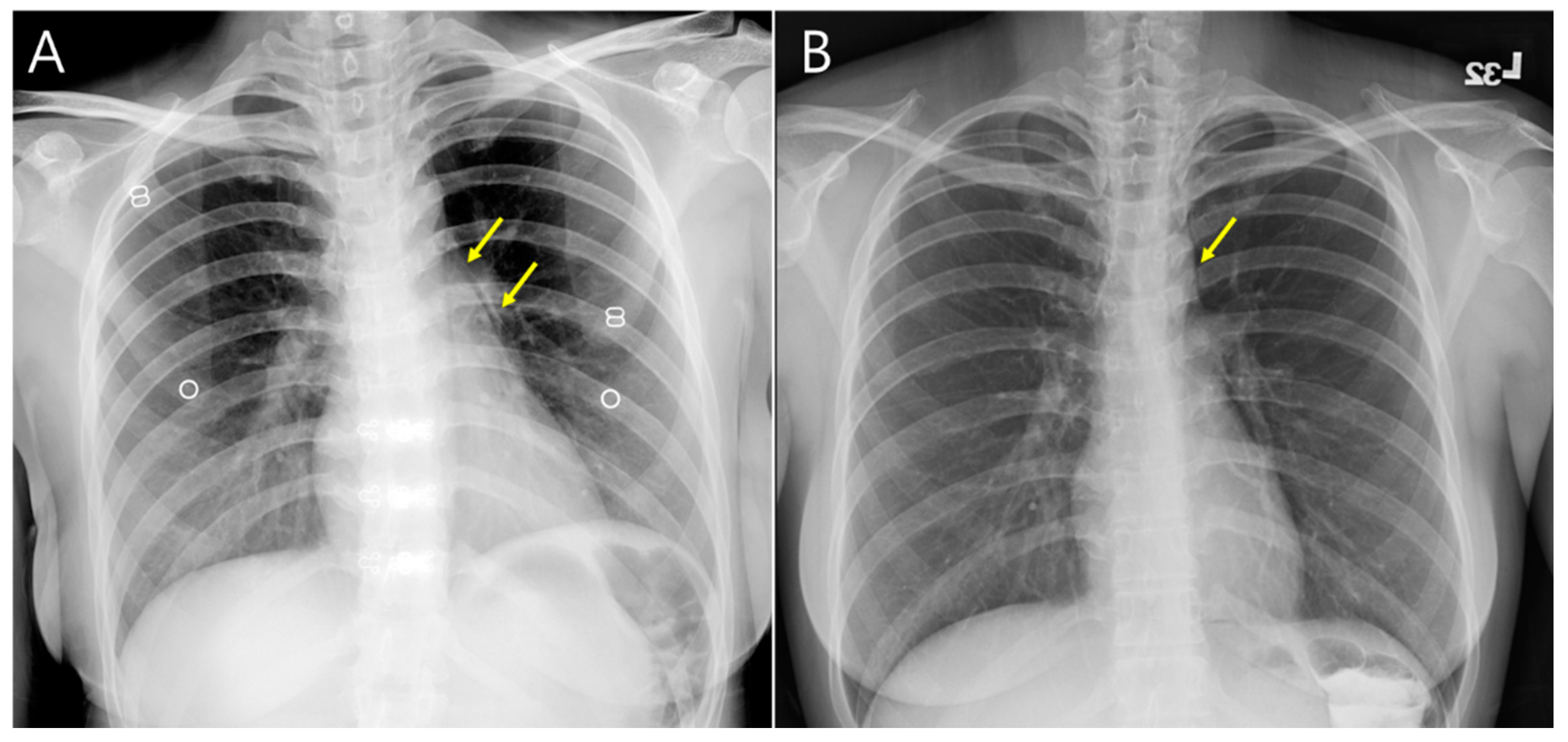 Medicina 59 00394 g005 Medicina 59 00394 g005