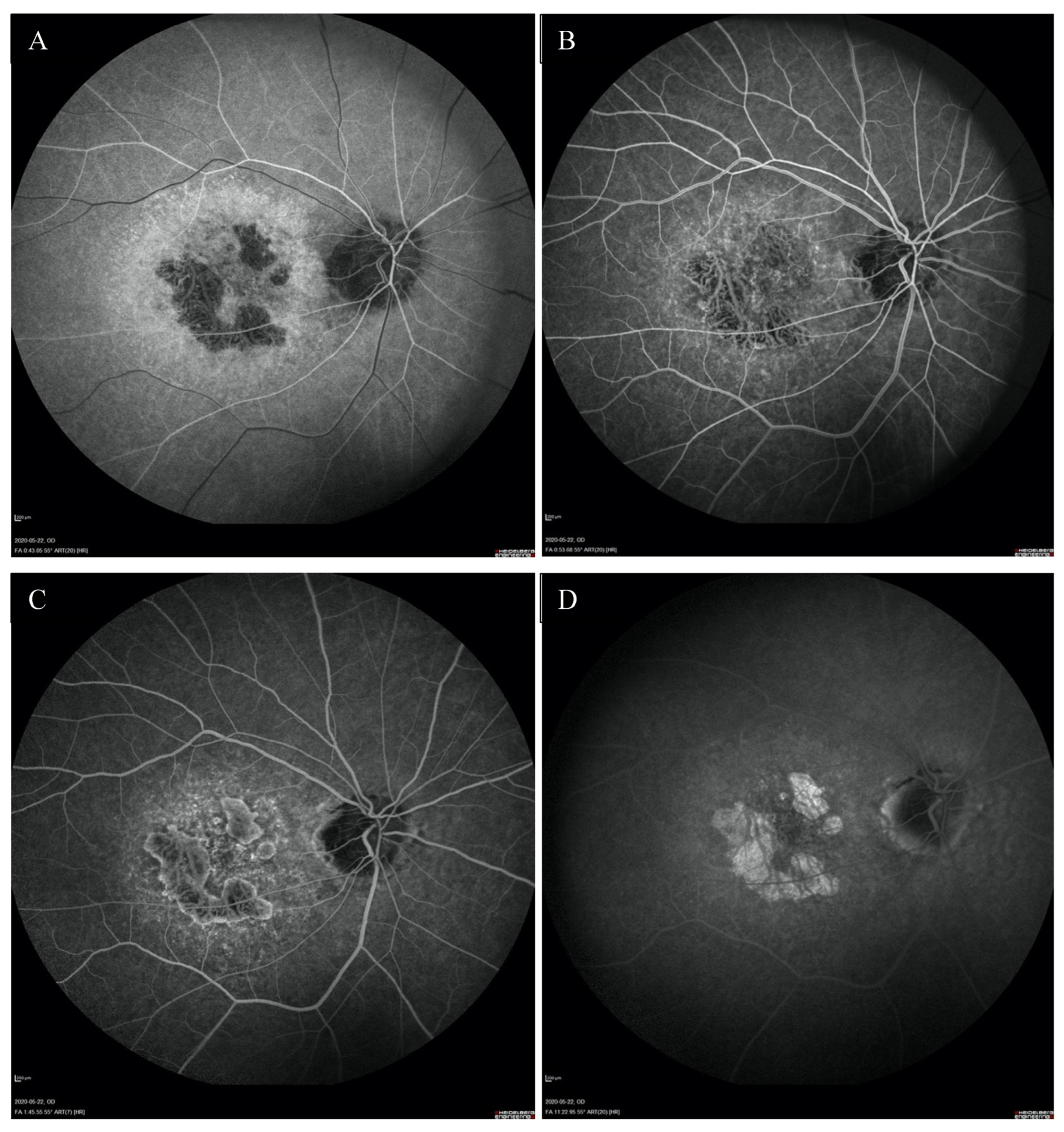 Medicina 59 00399 g004