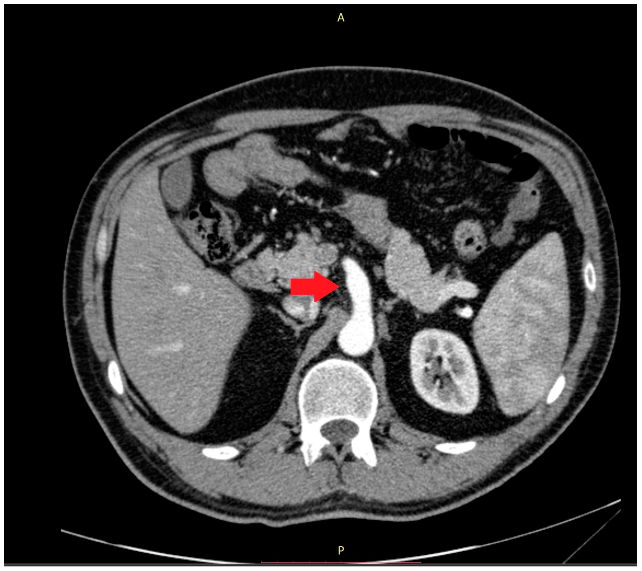 Medicina 59 00442 g002 Medicina 59 00442 g002