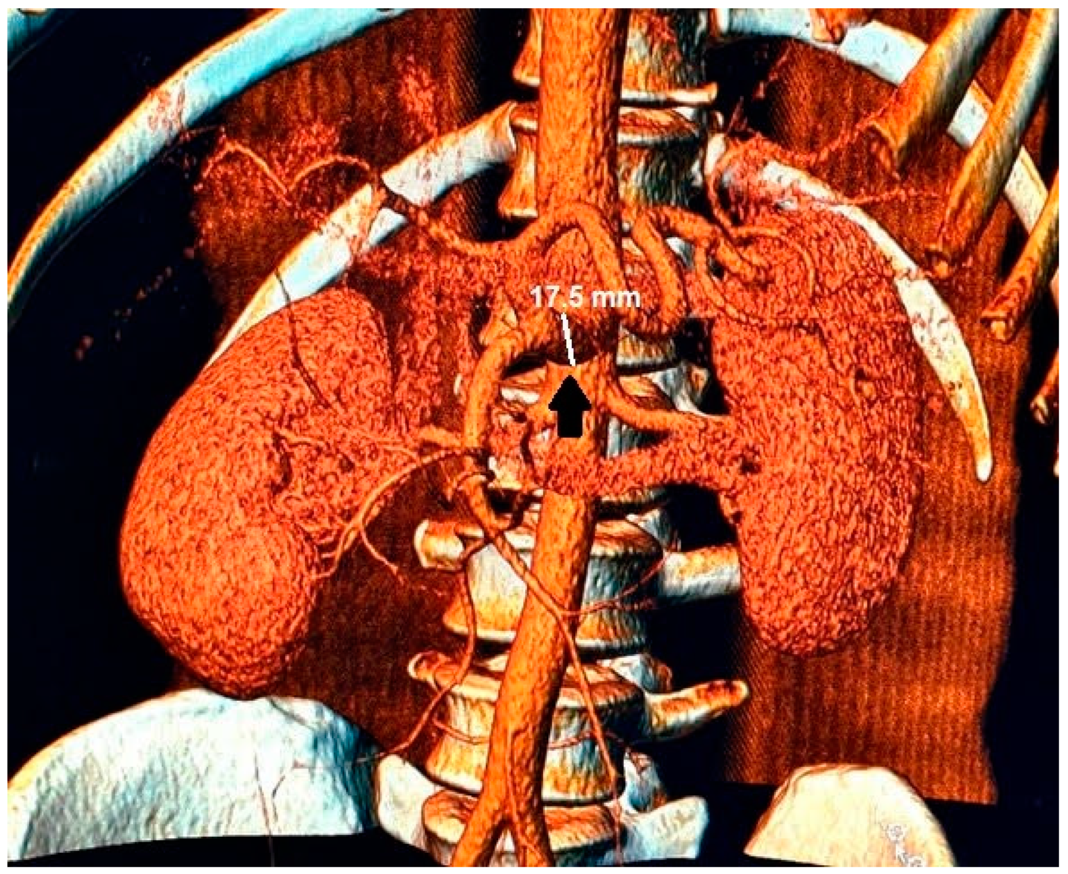Medicina 59 00442 g003 Medicina 59 00442 g003
