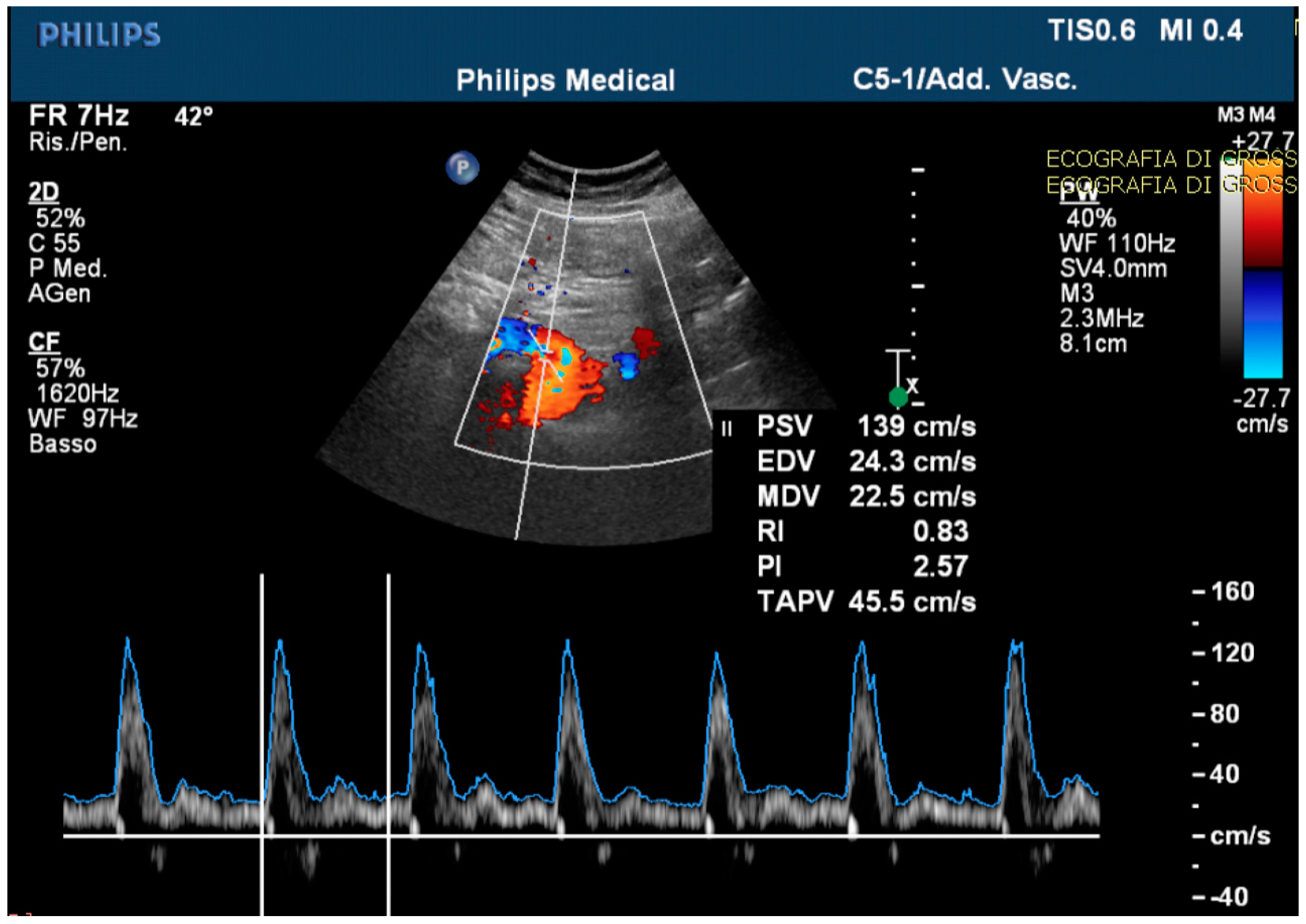 Medicina 59 00442 g004 Medicina 59 00442 g004