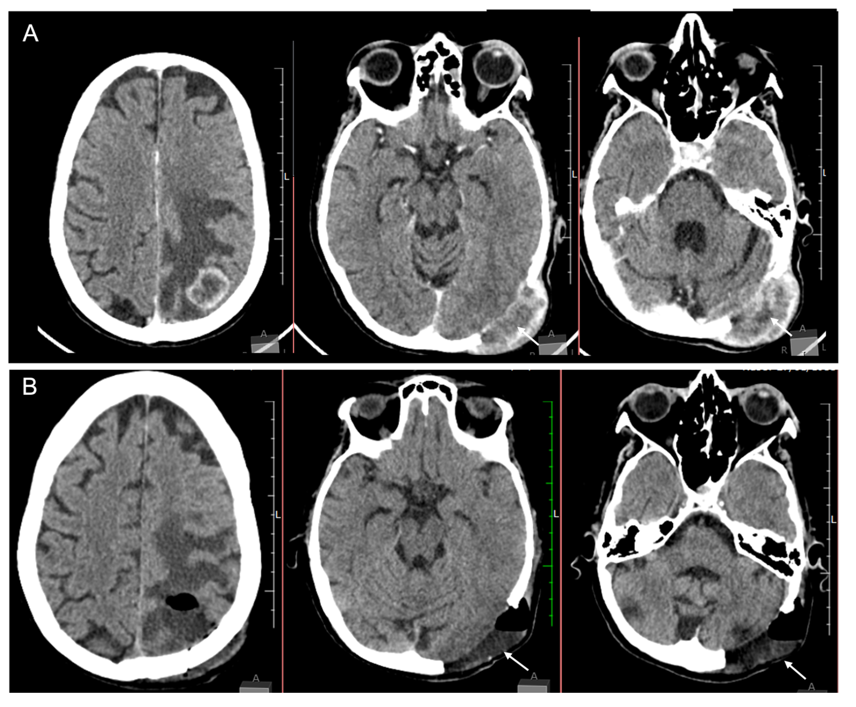 Medicina 59 00459 g002 Medicina 59 00459 g002