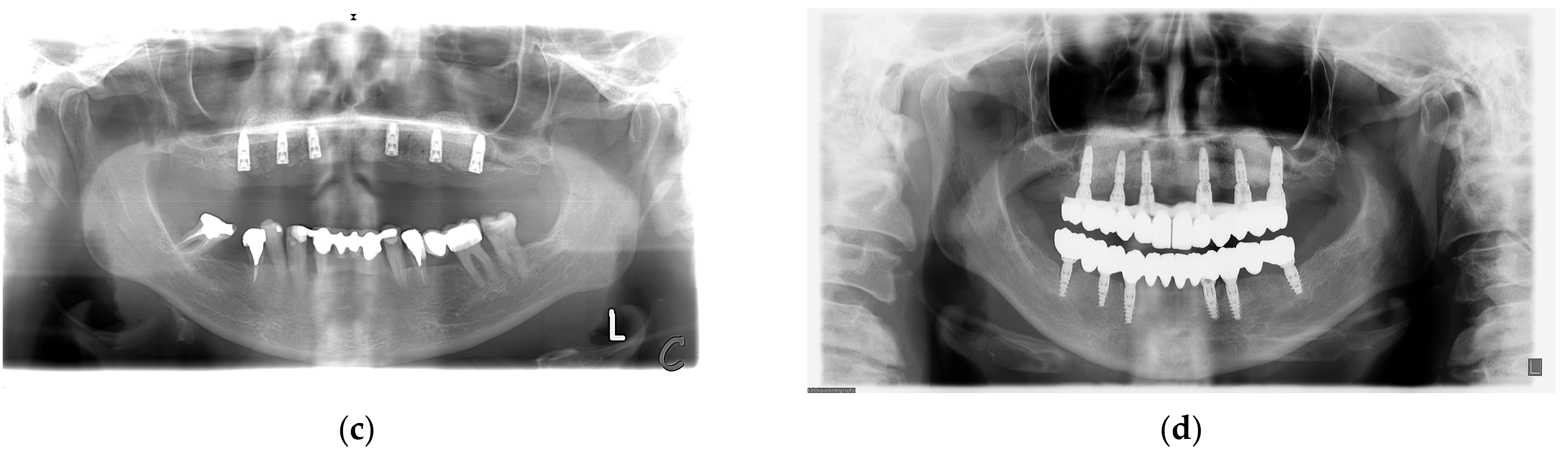 Medicina 59 00494 g003b