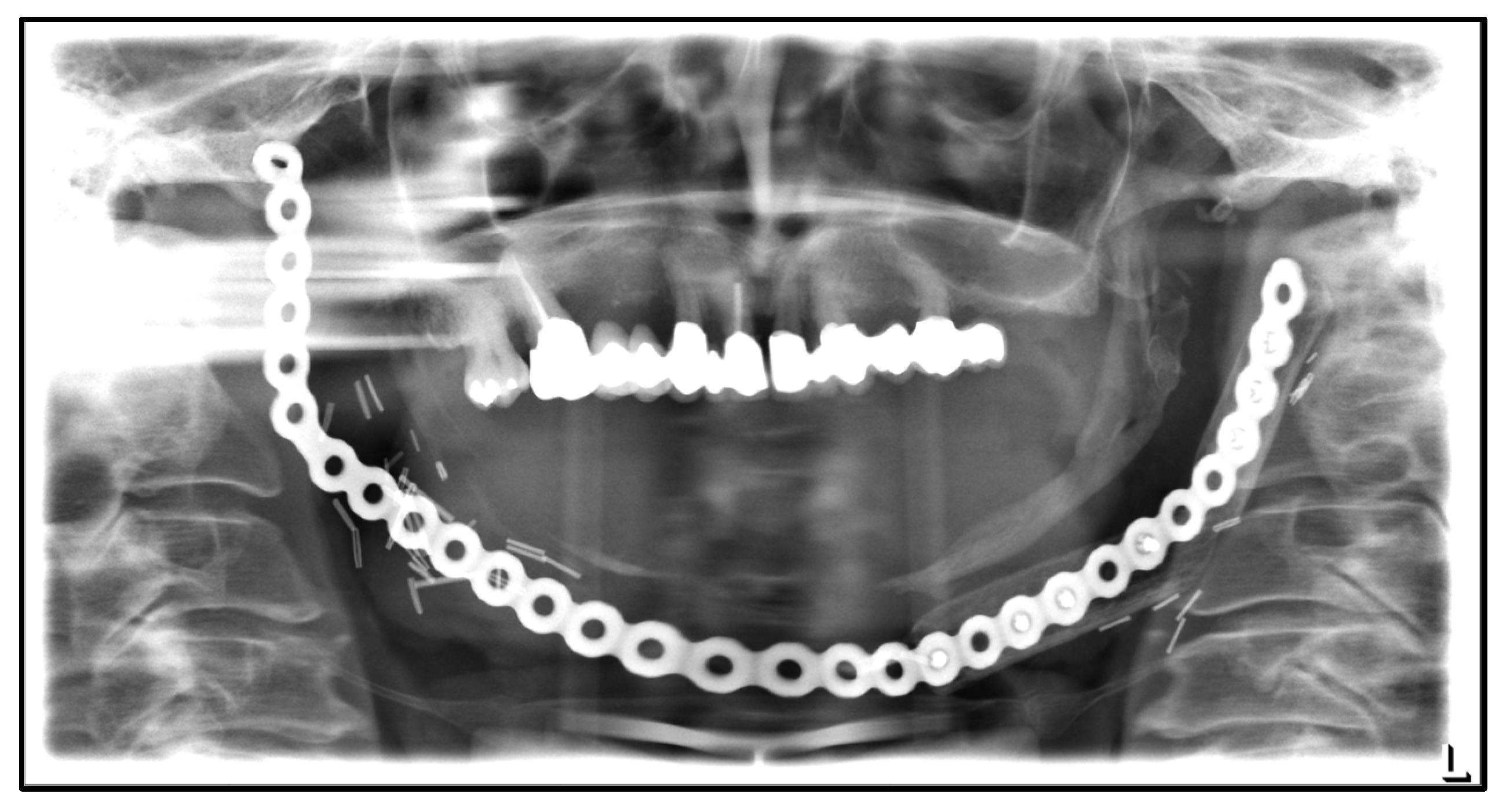 Medicina 59 00535 g011