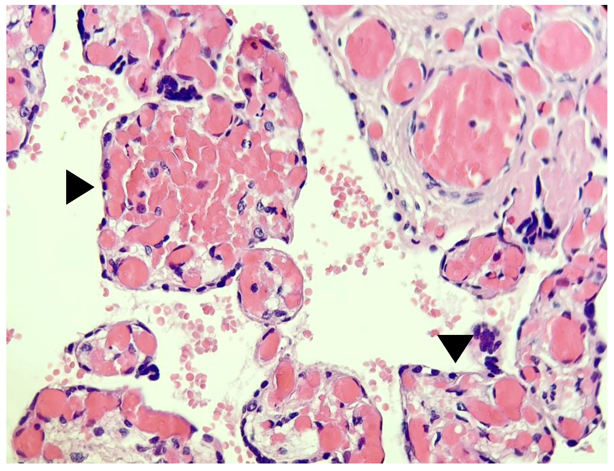 Medicina 59 00552 g002