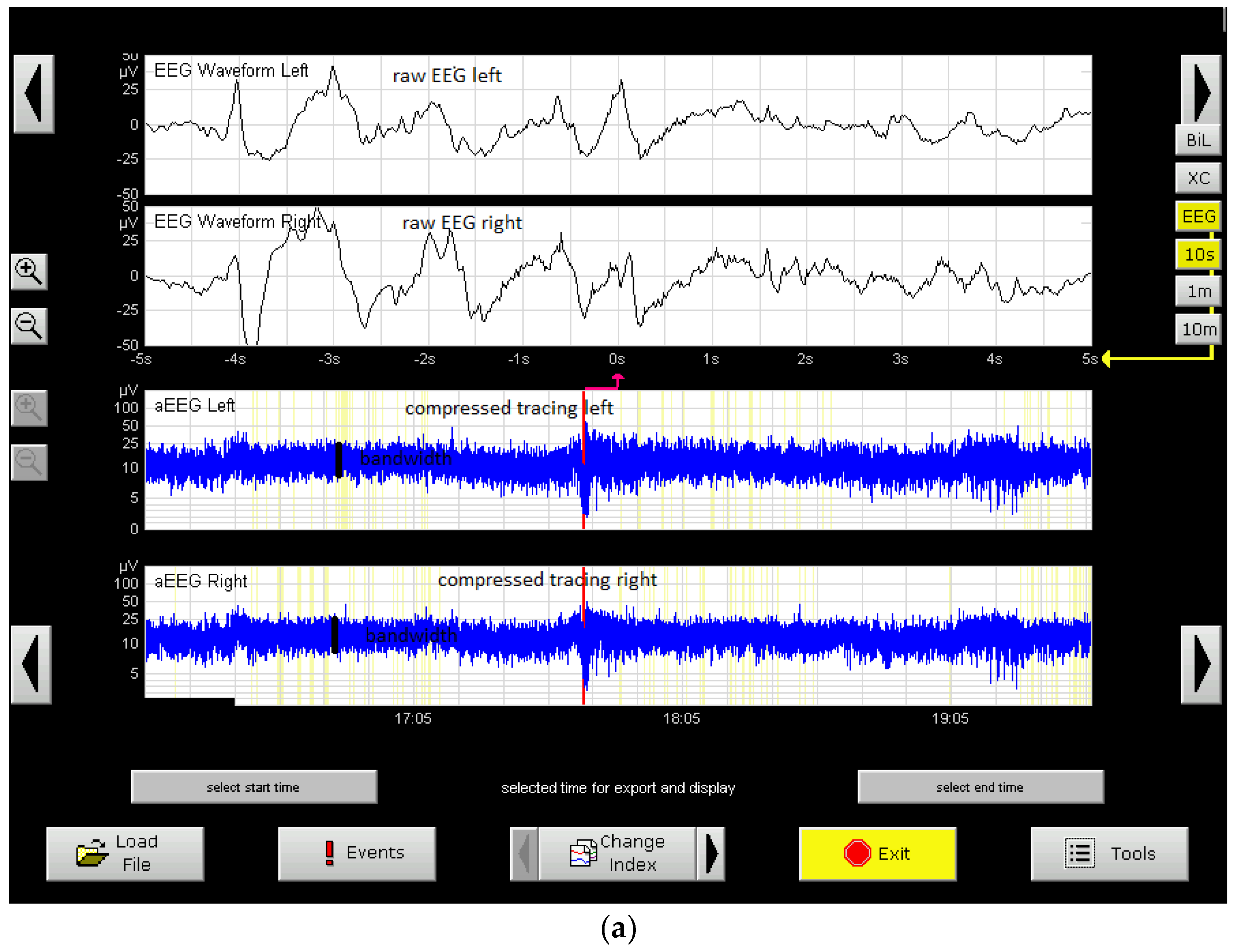 Medicina 59 00552 g005a