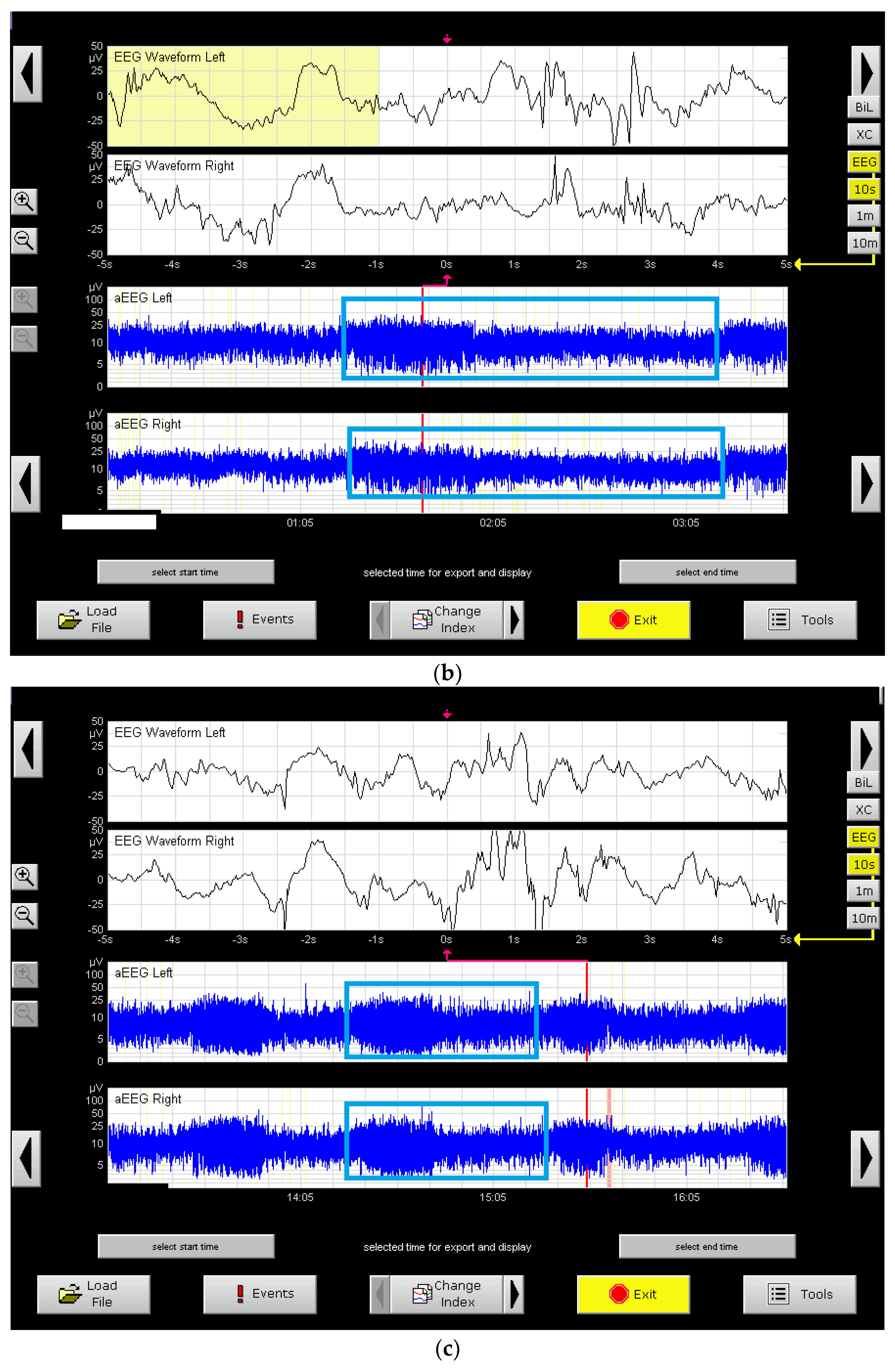 Medicina 59 00552 g005b