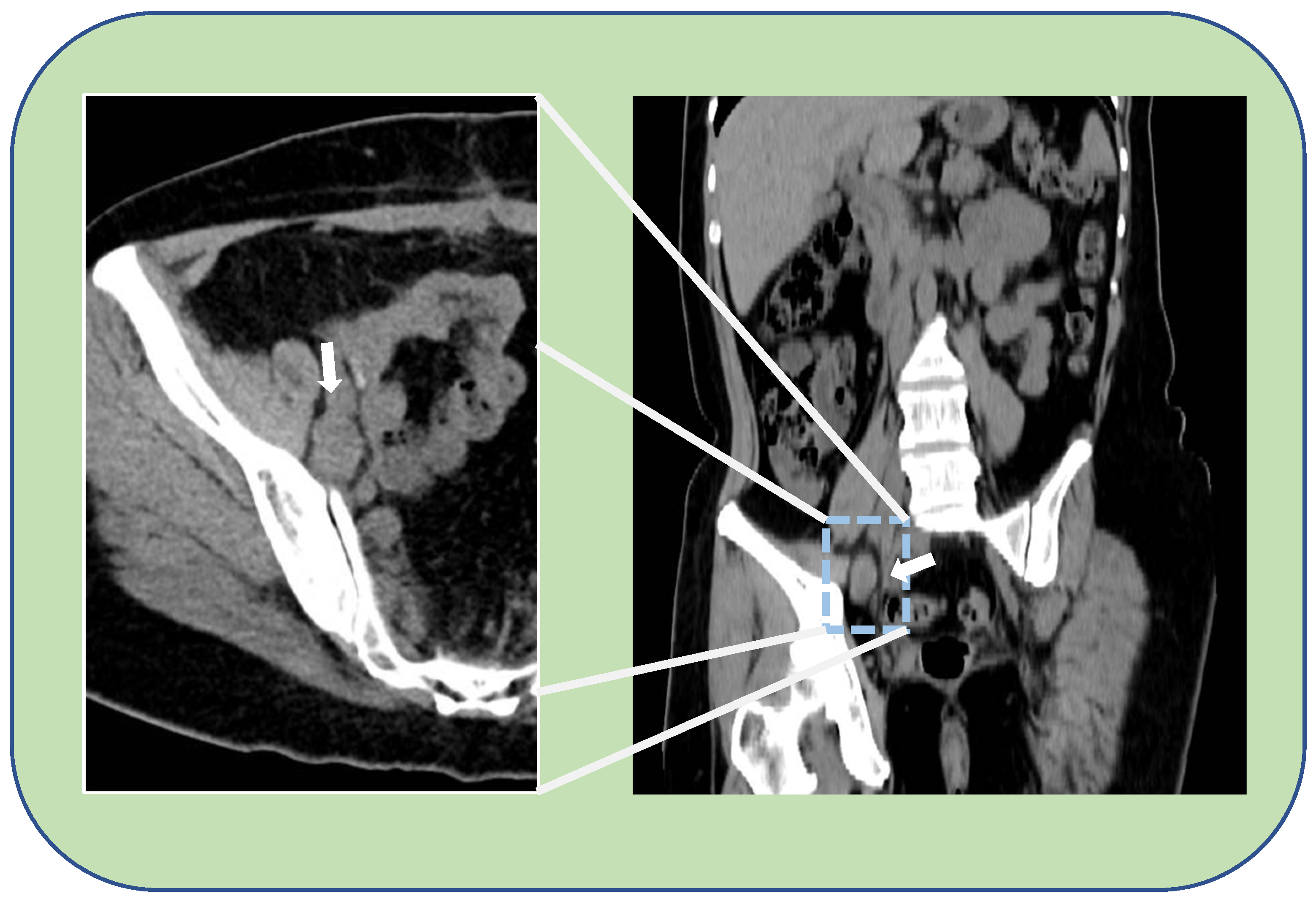 Medicina 59 00606 g001 Medicina 59 00606 g001