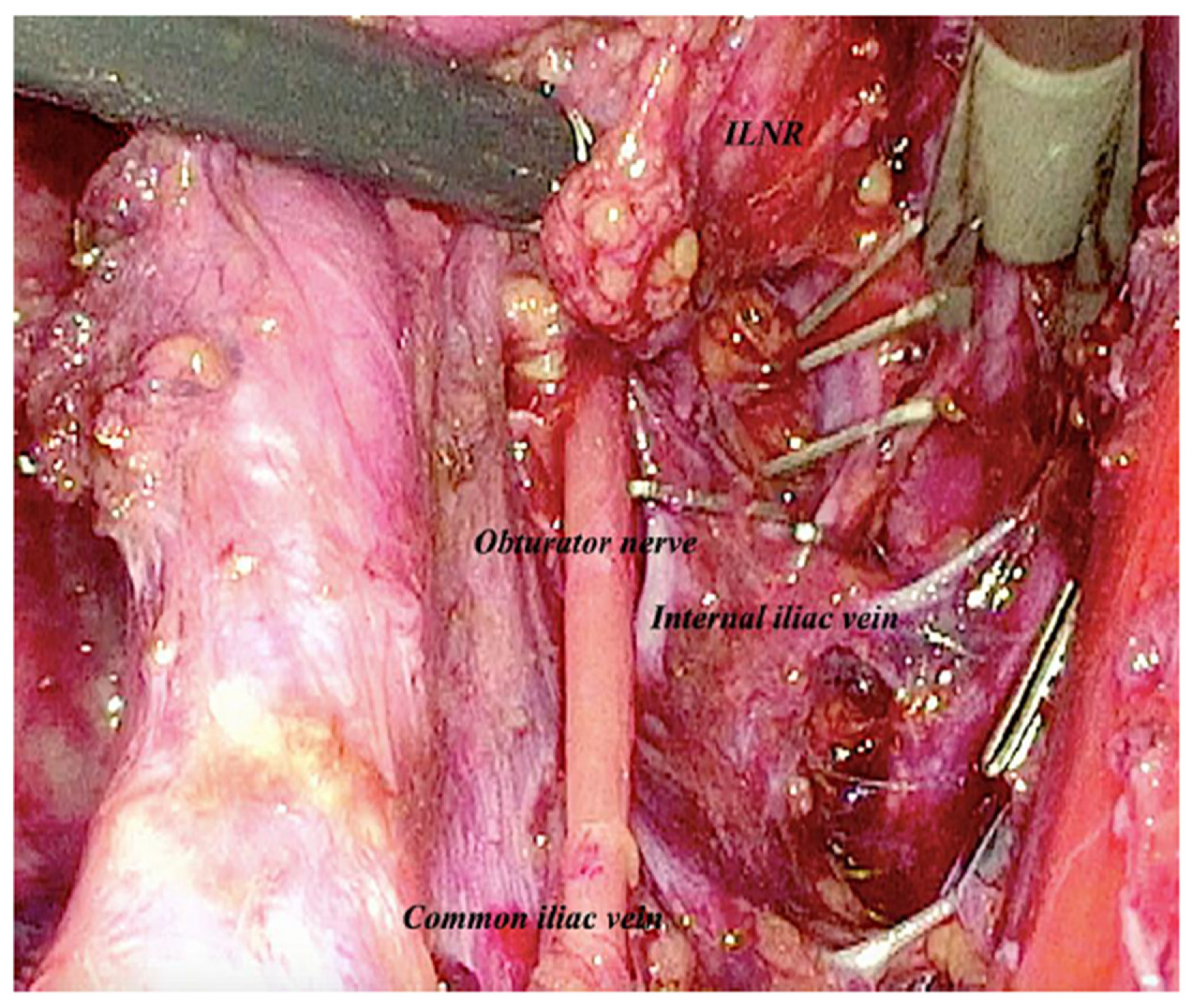Medicina 59 00606 g004 Medicina 59 00606 g004