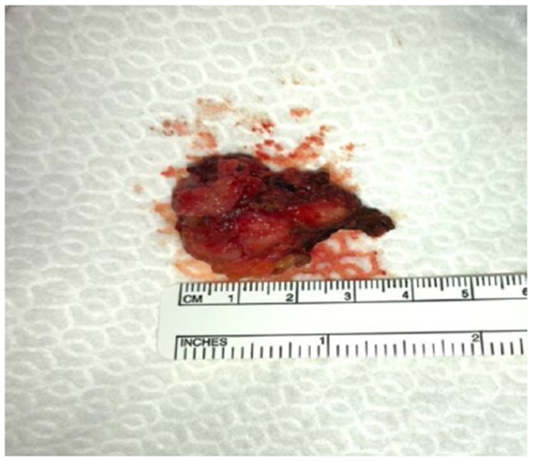 Medicina 59 00606 g005 Medicina 59 00606 g005