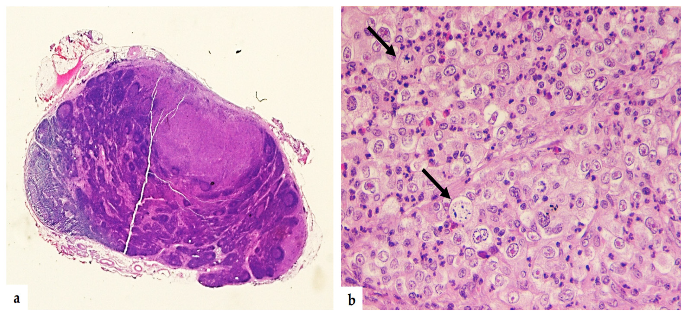 Medicina 59 00606 g006 Medicina 59 00606 g006