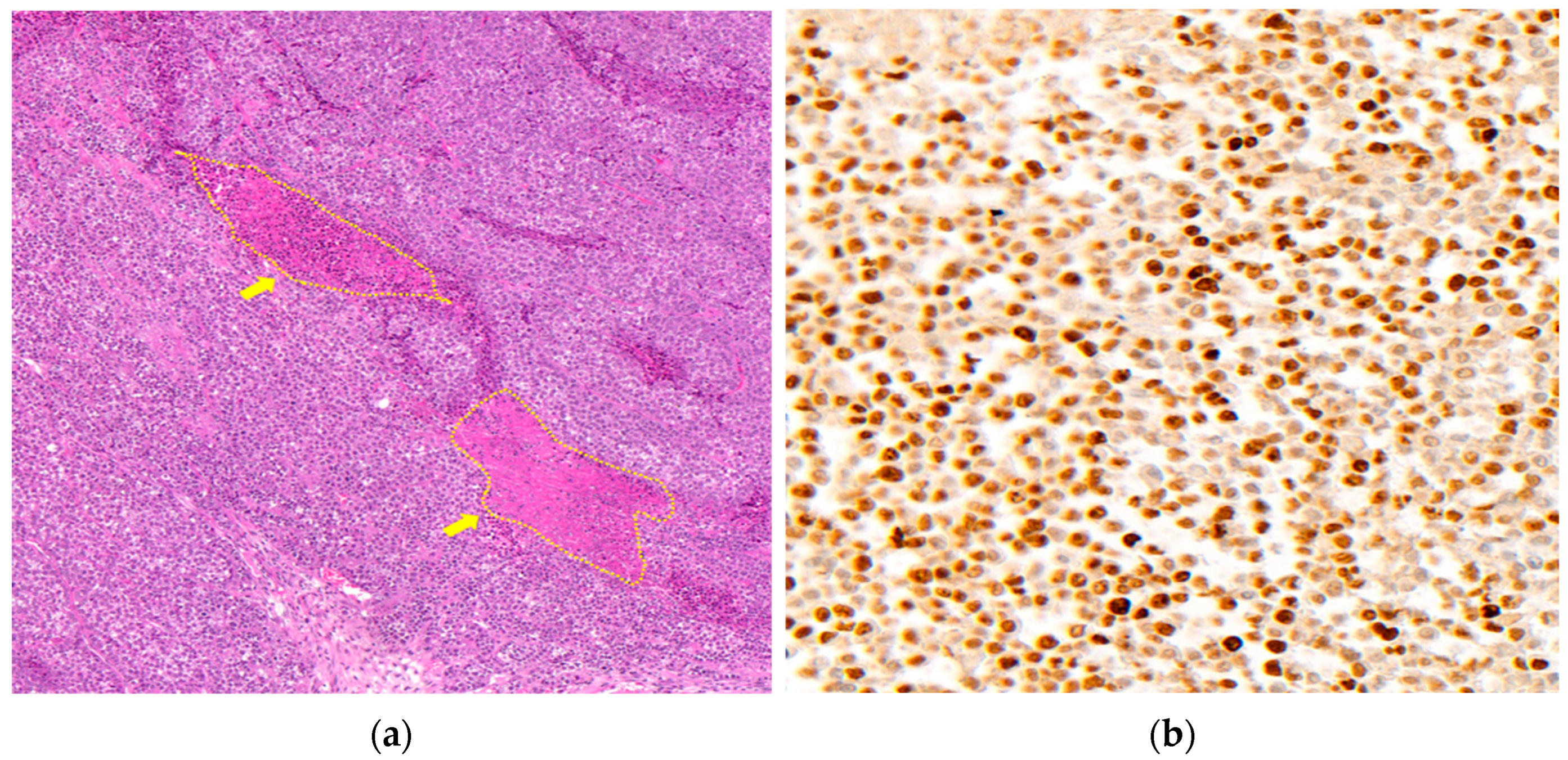 Medicina 59 00613 g006