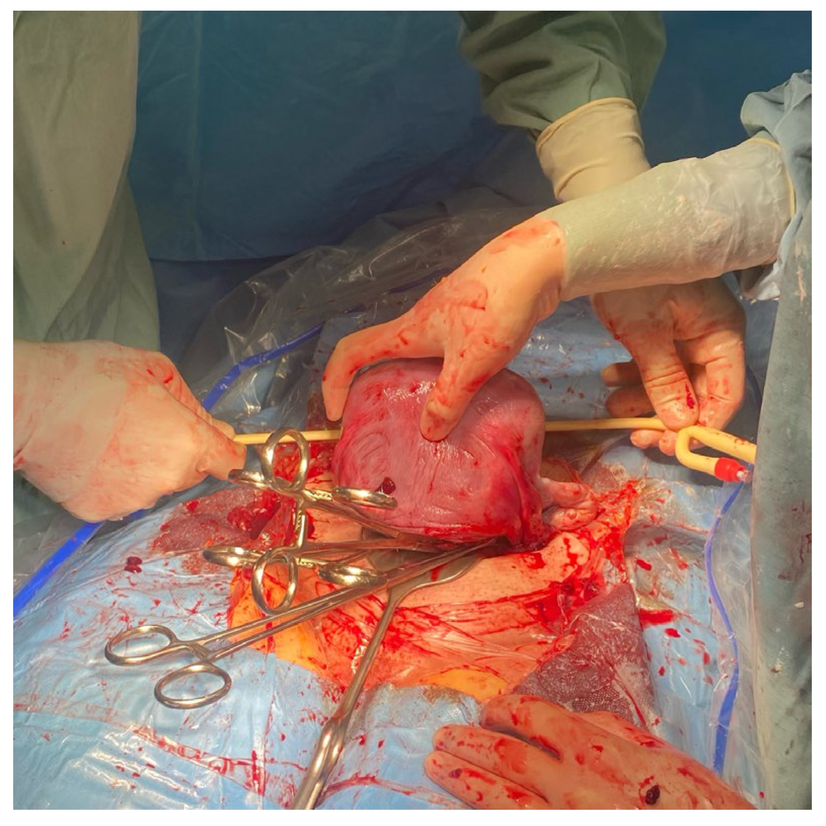 Medicina 59 00641 g001