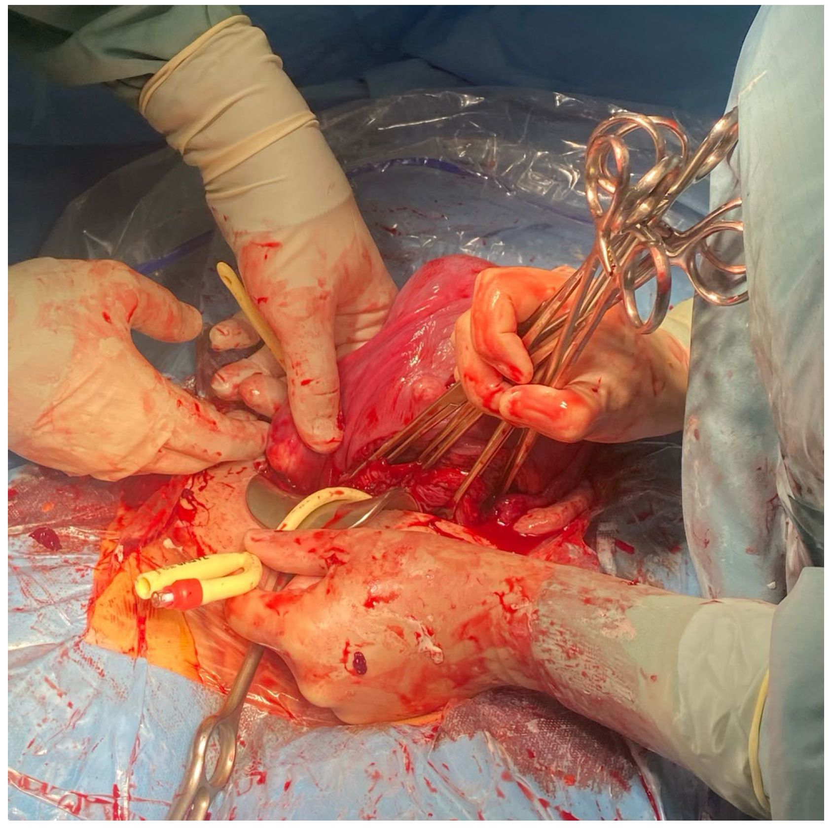 Medicina 59 00641 g003