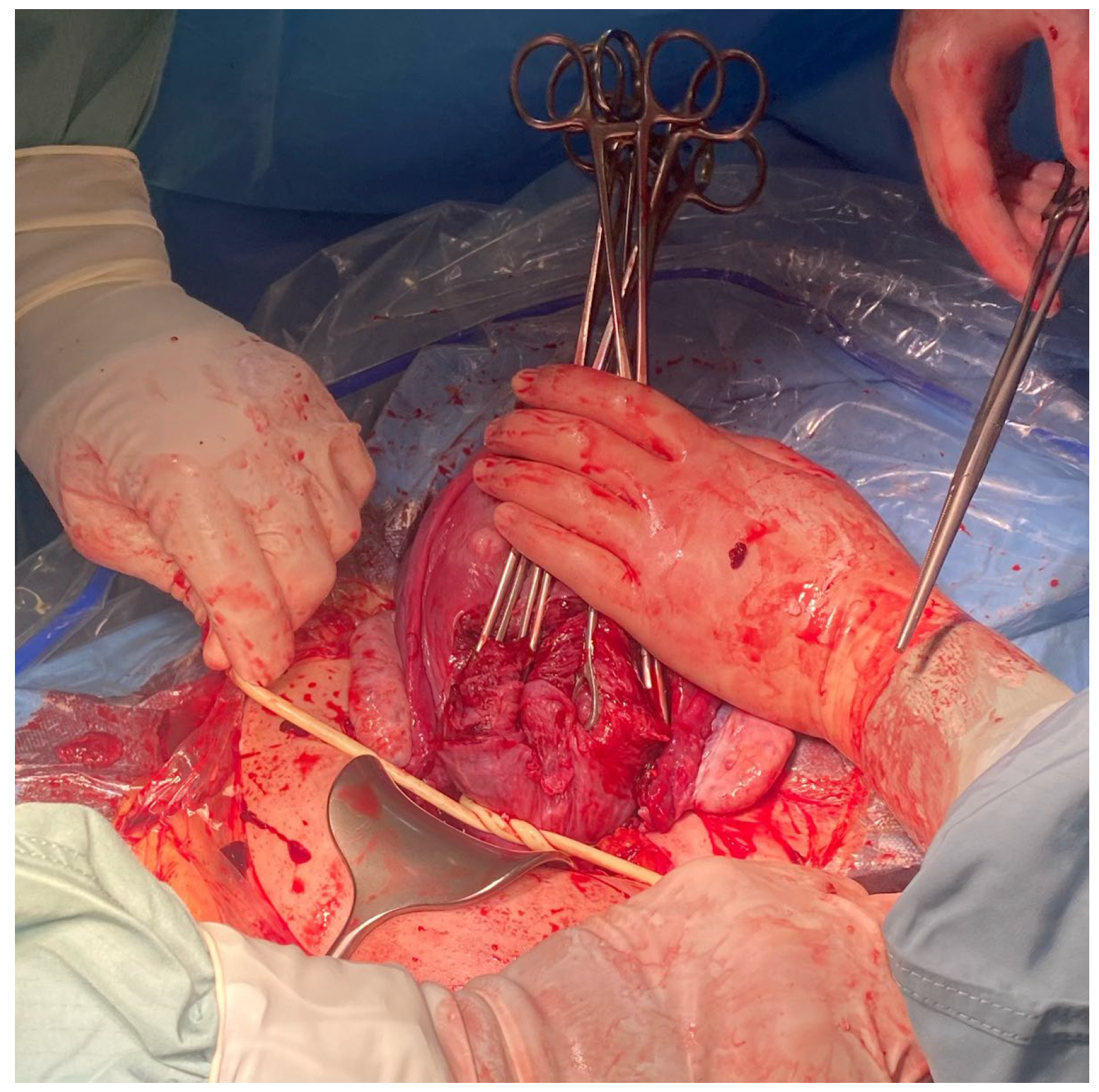 Medicina 59 00641 g005