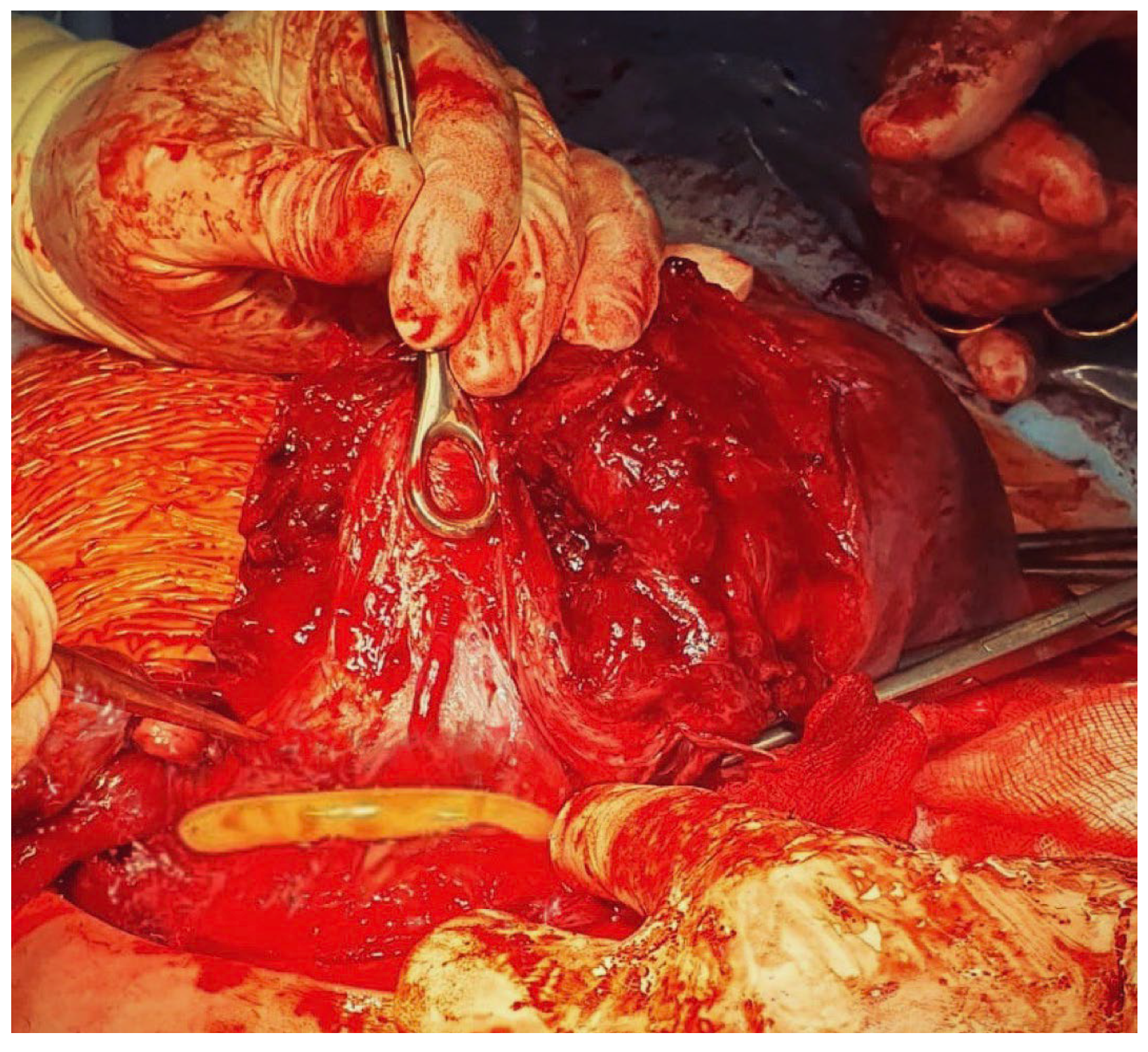 Medicina 59 00641 g008