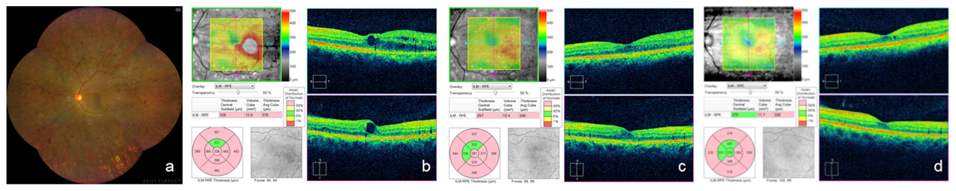 Medicina 59 00665 g003 Medicina 59 00665 g003
