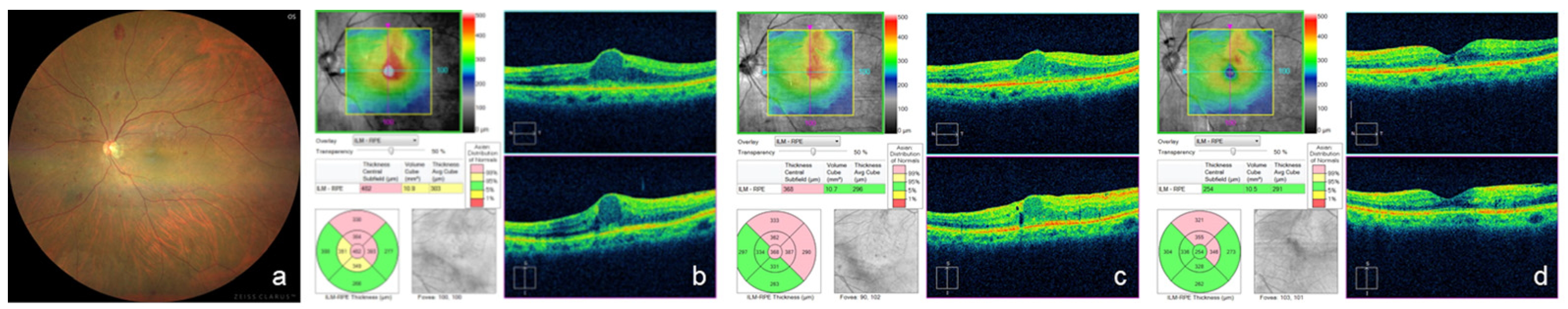 Medicina 59 00665 g004 Medicina 59 00665 g004