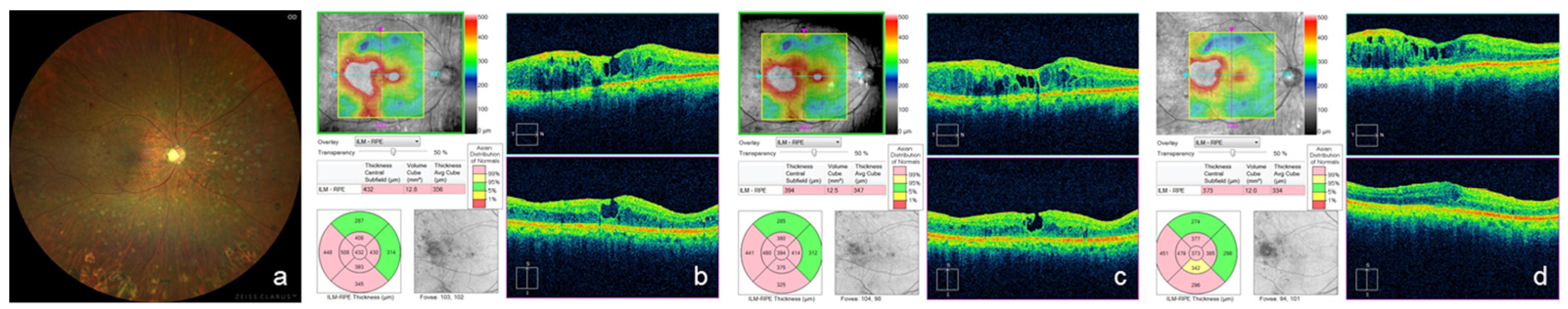 Medicina 59 00665 g005 Medicina 59 00665 g005
