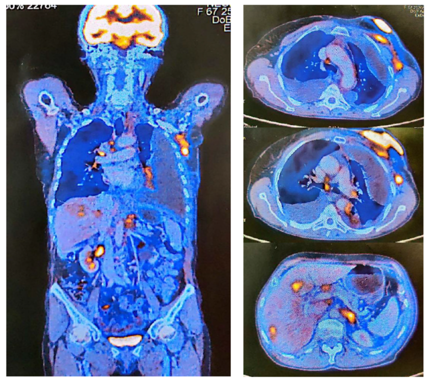 Medicina 59 00696 g002