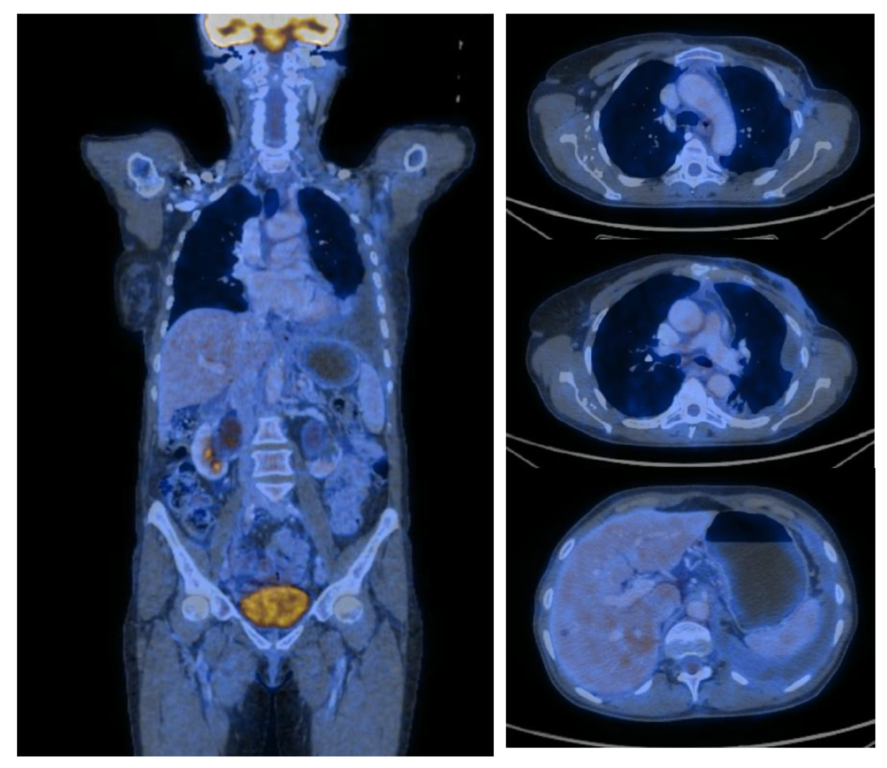 Medicina 59 00696 g003