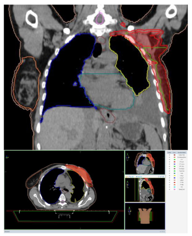 Medicina 59 00696 g004