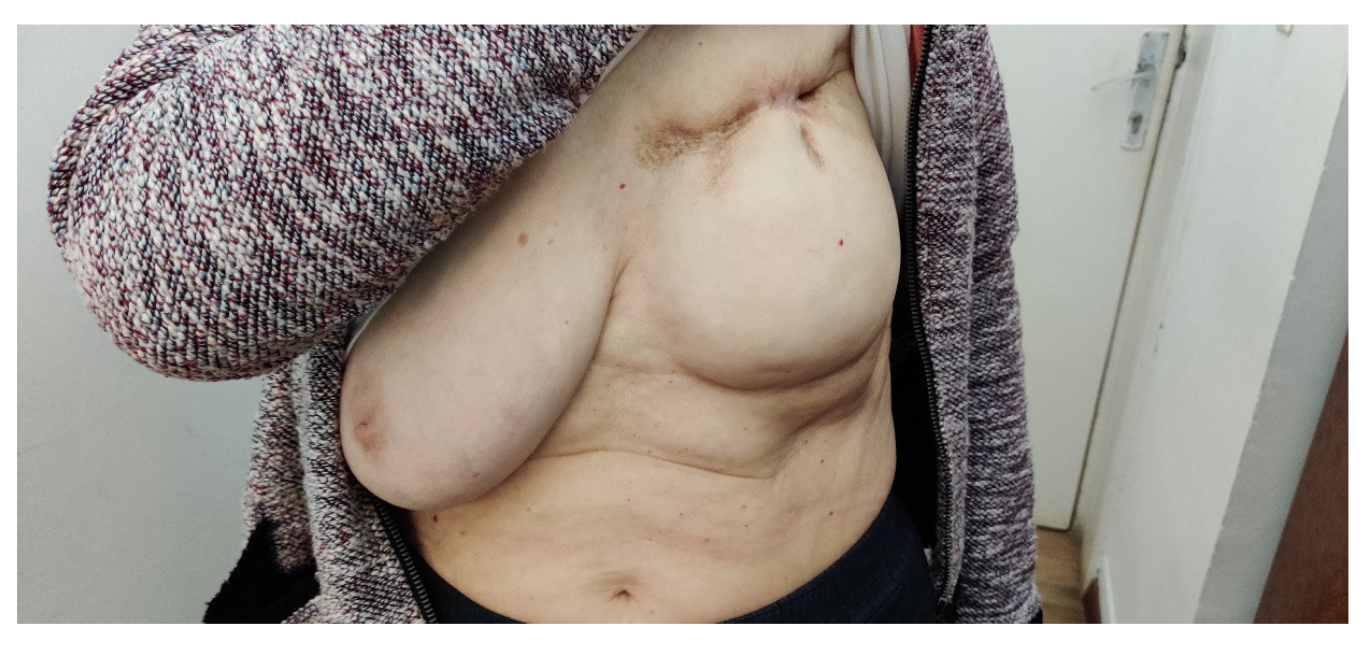 Medicina 59 00696 g006