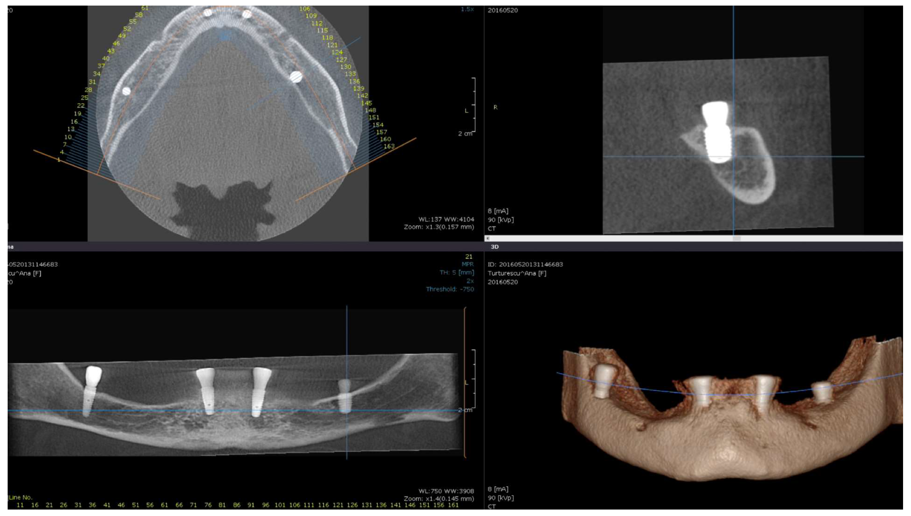 Medicina 59 00697 g002 Medicina 59 00697 g002