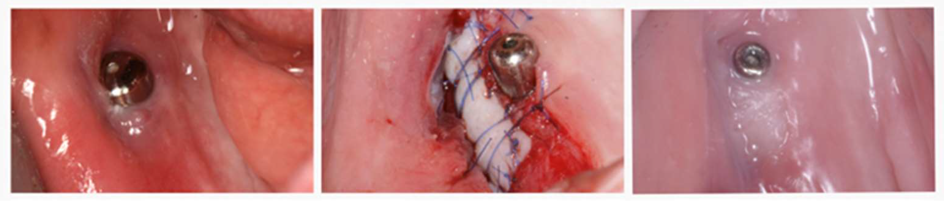 Medicina 59 00697 g003 Medicina 59 00697 g003