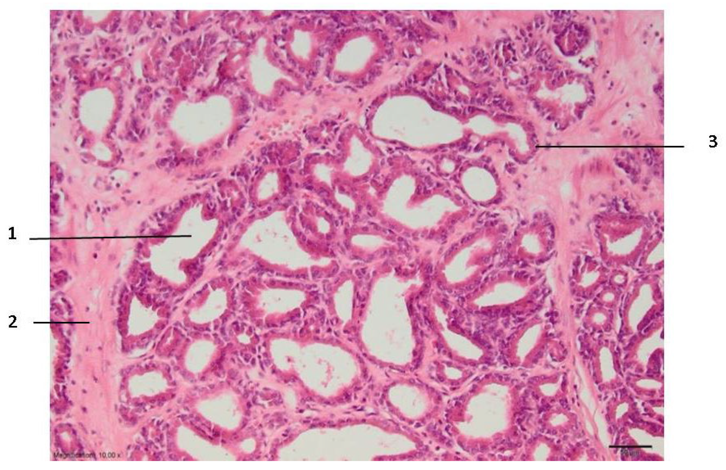 Medicina 59 00702 g005