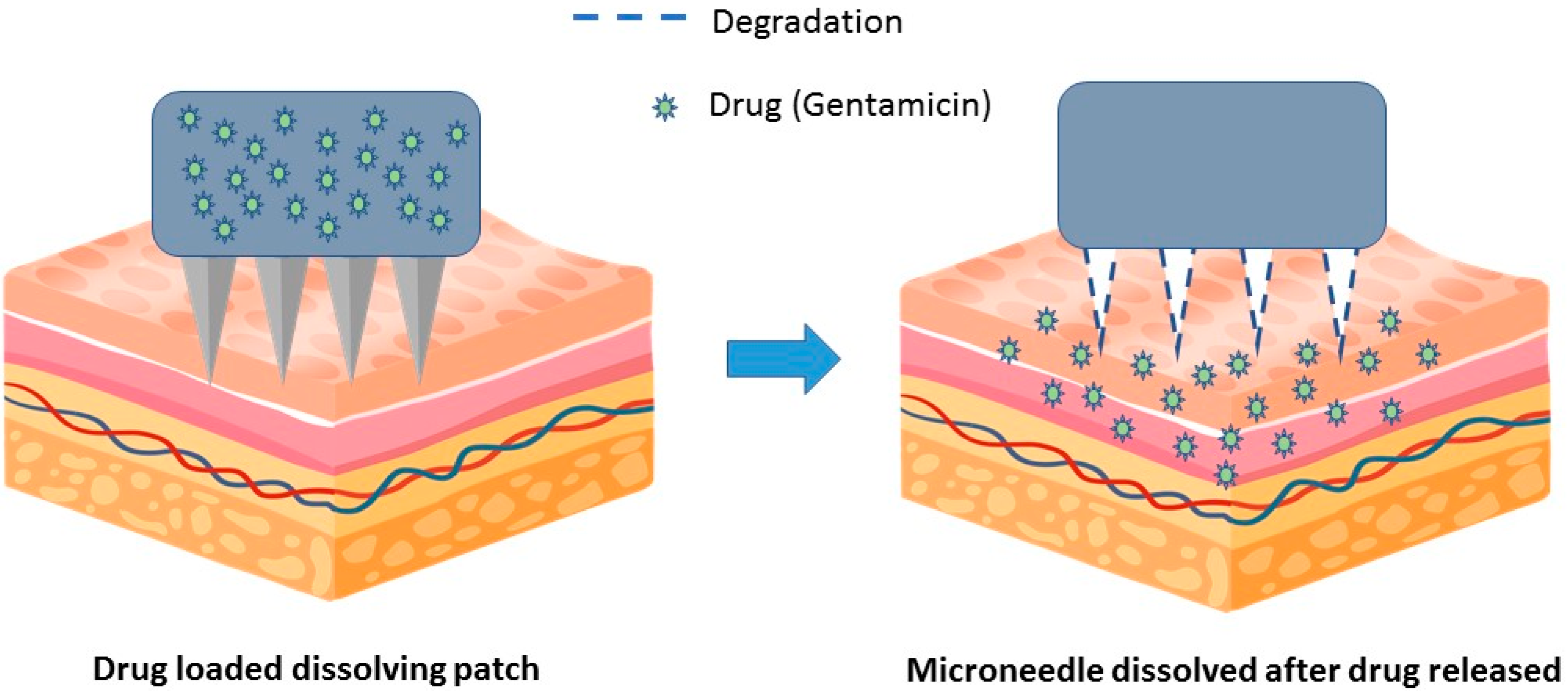 Medicina 59 00778 g005