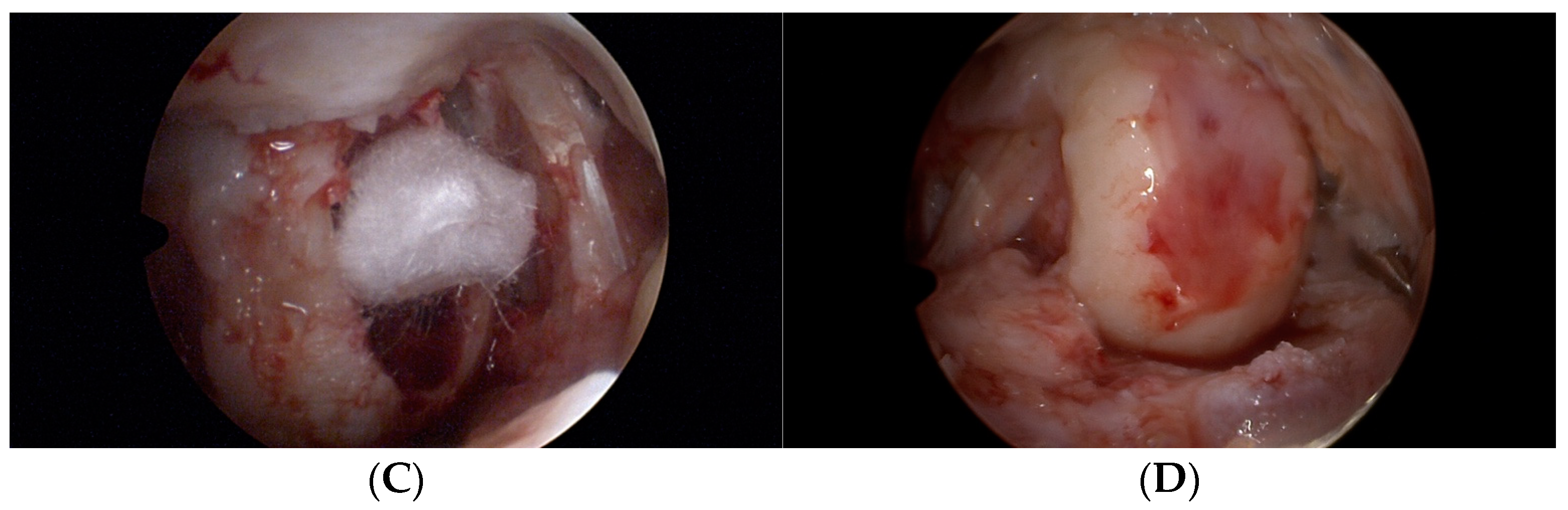 Medicina 59 00804 g003b Medicina 59 00804 g003b