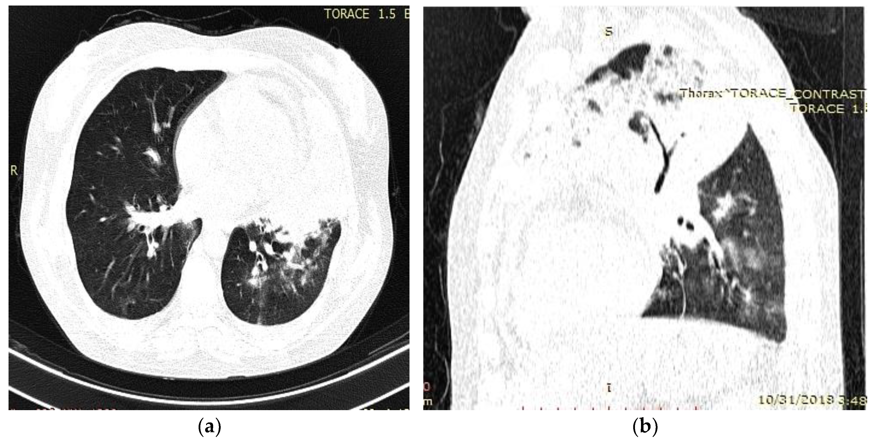 Medicina 59 00806 g002