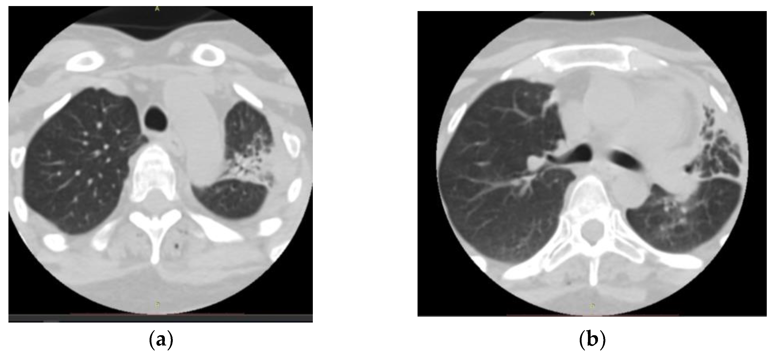 Medicina 59 00806 g003