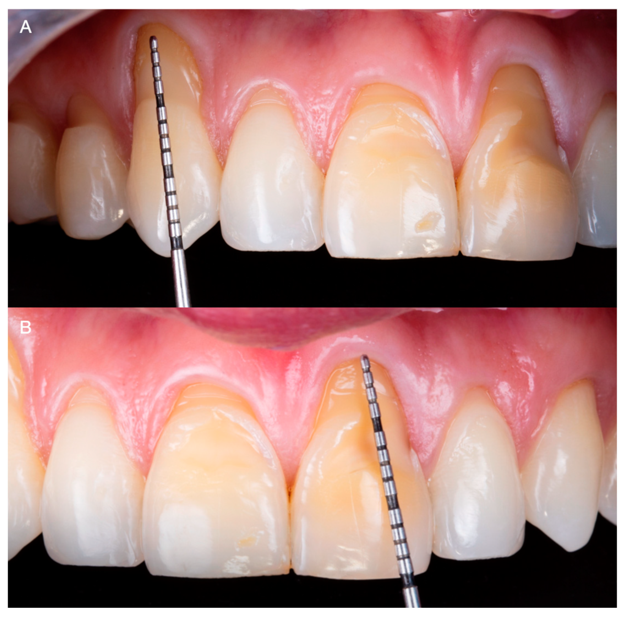 Medicina 59 00822 g002