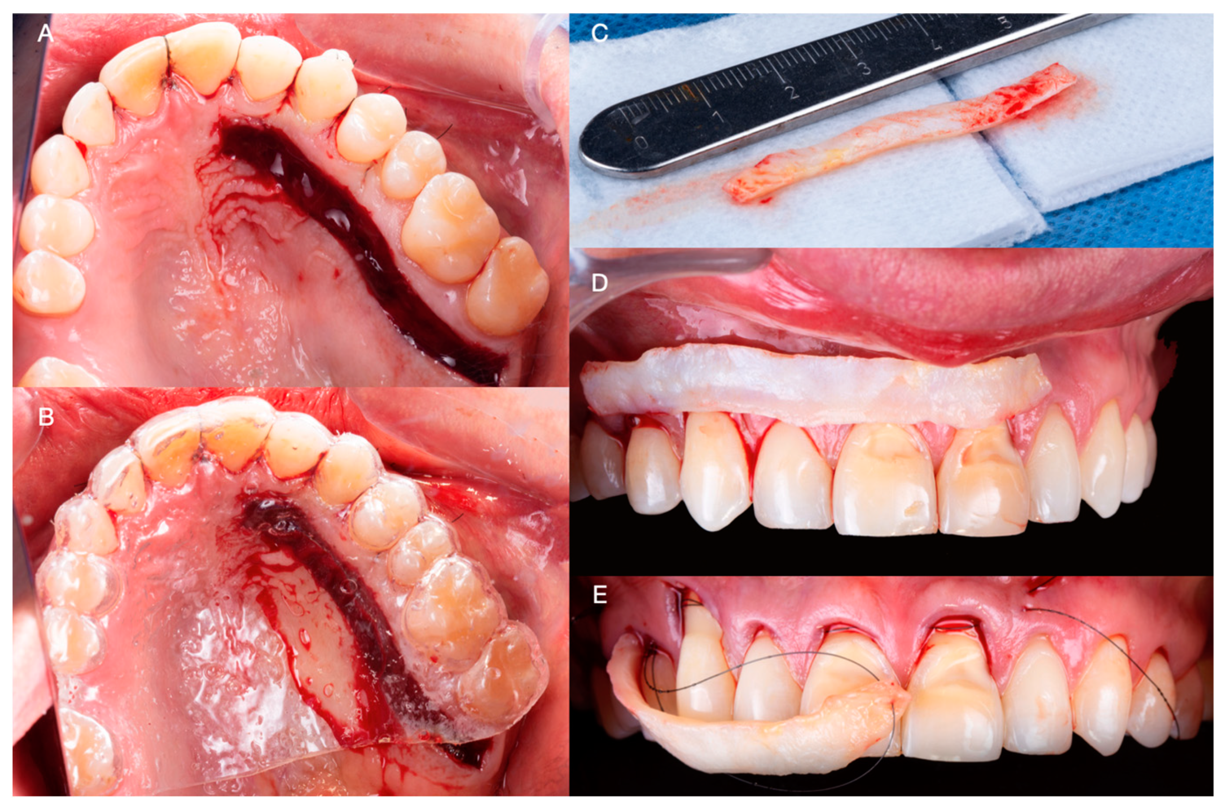 Medicina 59 00822 g004