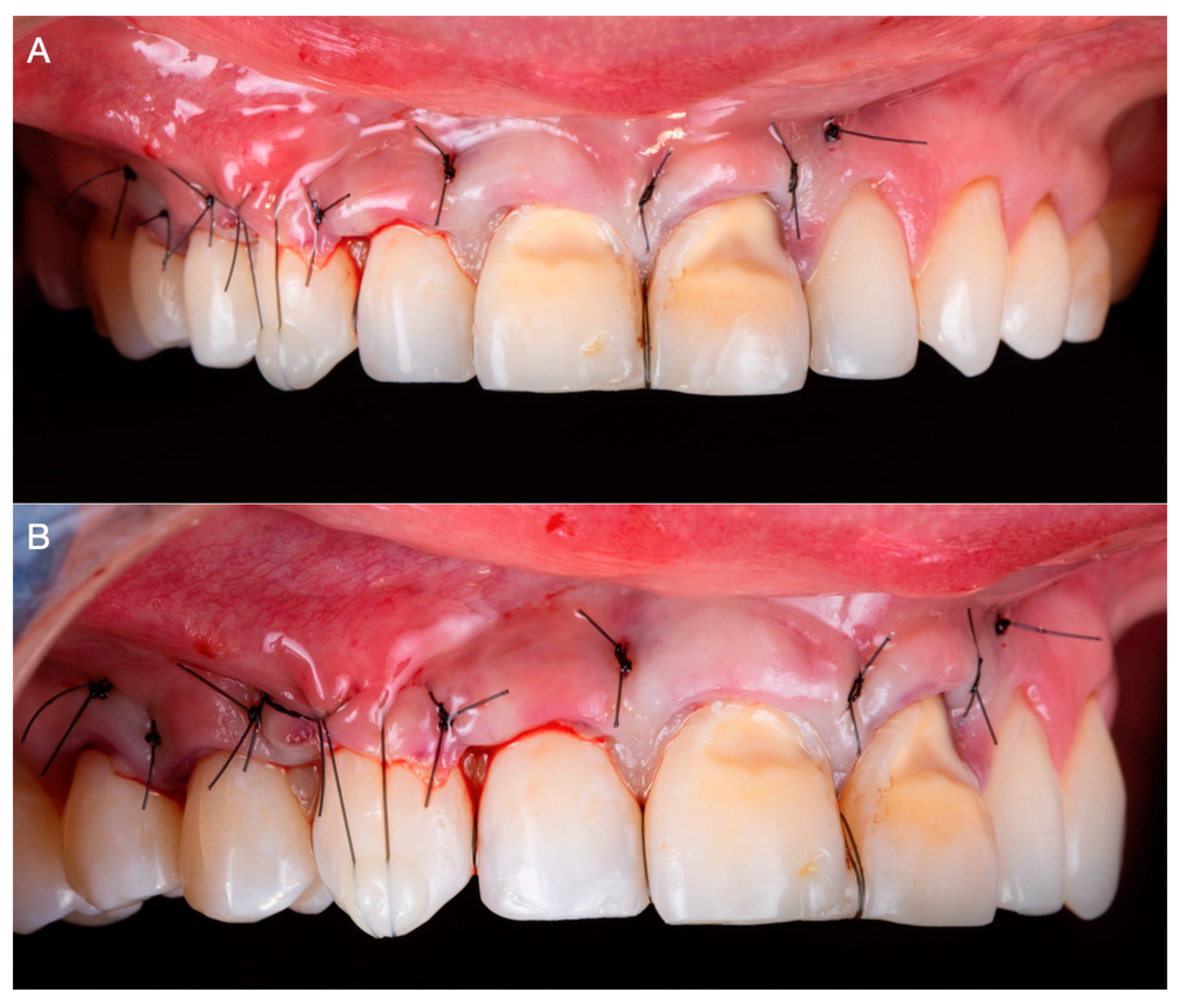 Medicina 59 00822 g005